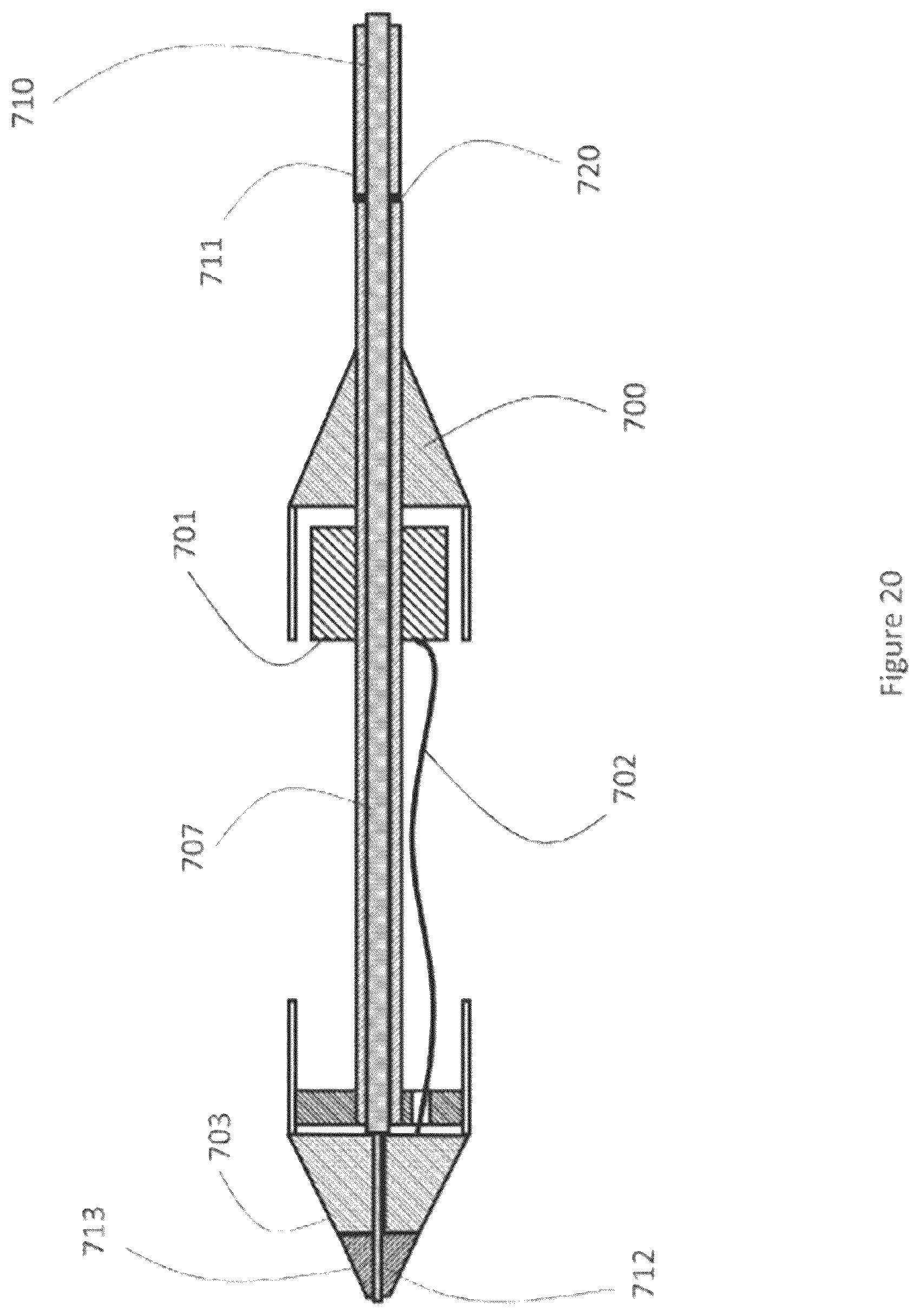 Patent US12616593 Figure 20 – Heart valve prosthesis delivery system and method for delivery of heart valve prosthesis with introducer sheath and loading system