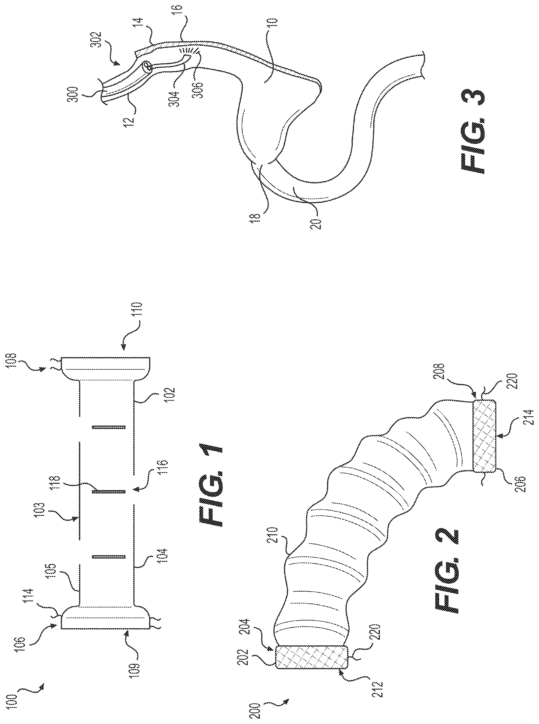 Patent US12616594 Figure 1 – Gastrointestinal bypass devices and related methods of use