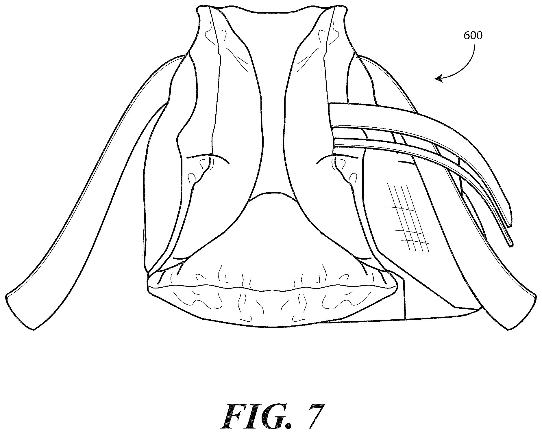 Patent US12616595 Figure 5 – Heel protector and corresponding rehabilitation systems and methods for using the same