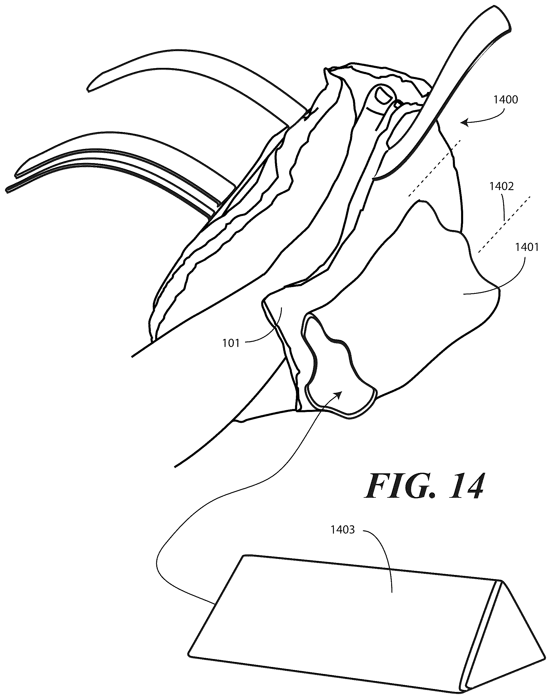 Patent US12616595 Figure 10 – Heel protector and corresponding rehabilitation systems and methods for using the same