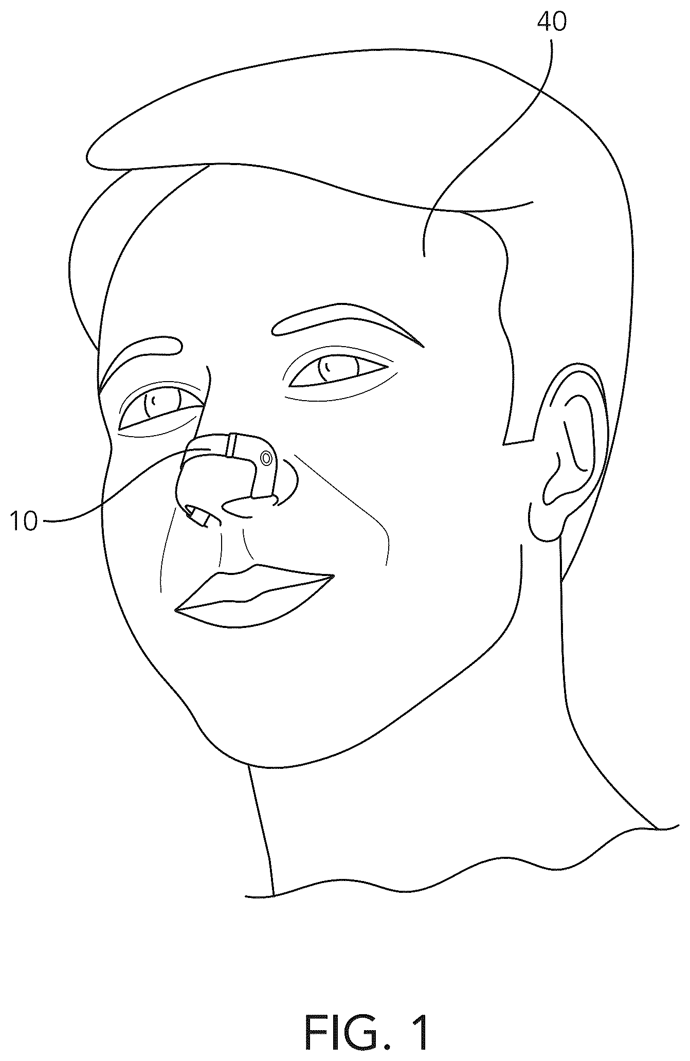 Patent US12616597 — Nasal dilating device — Figure 1