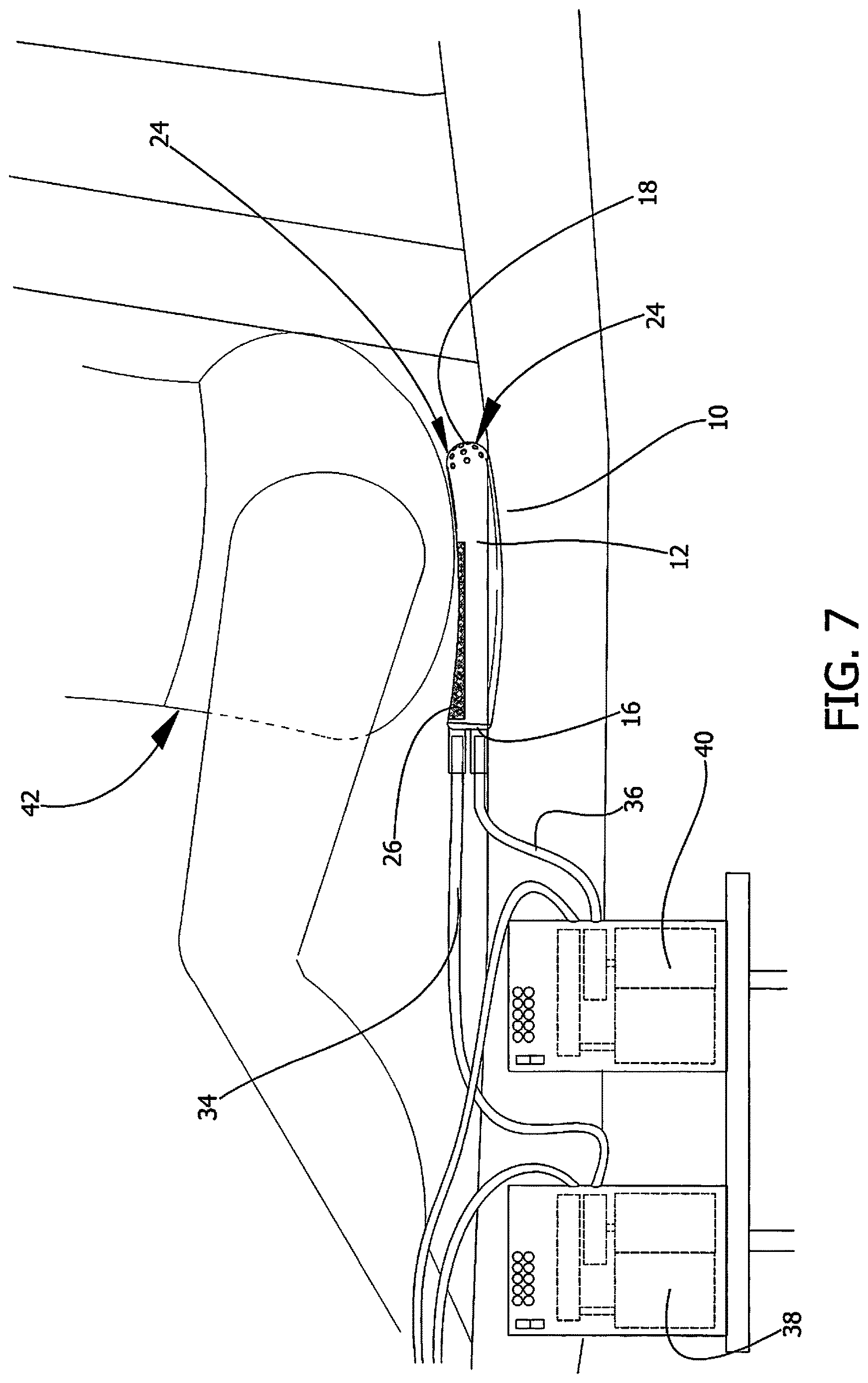Patent US12616604 Figure 6 – External catheter apparatus