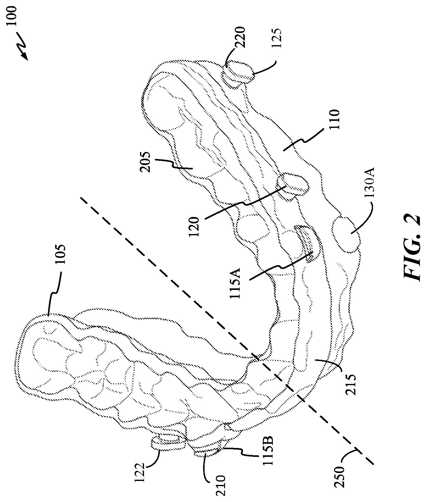 Patent US12616605 Figure 2 – Mandibular repositioning device