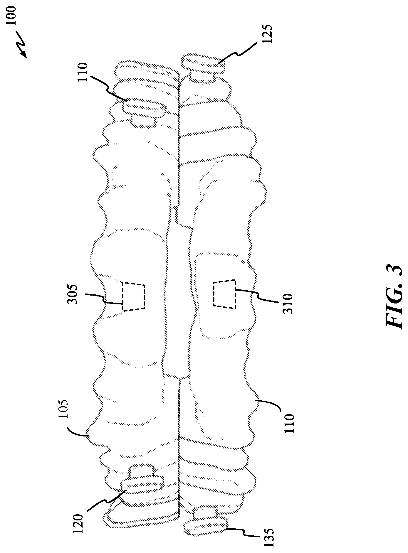 Patent US12616605 Figure 3 – Mandibular repositioning device