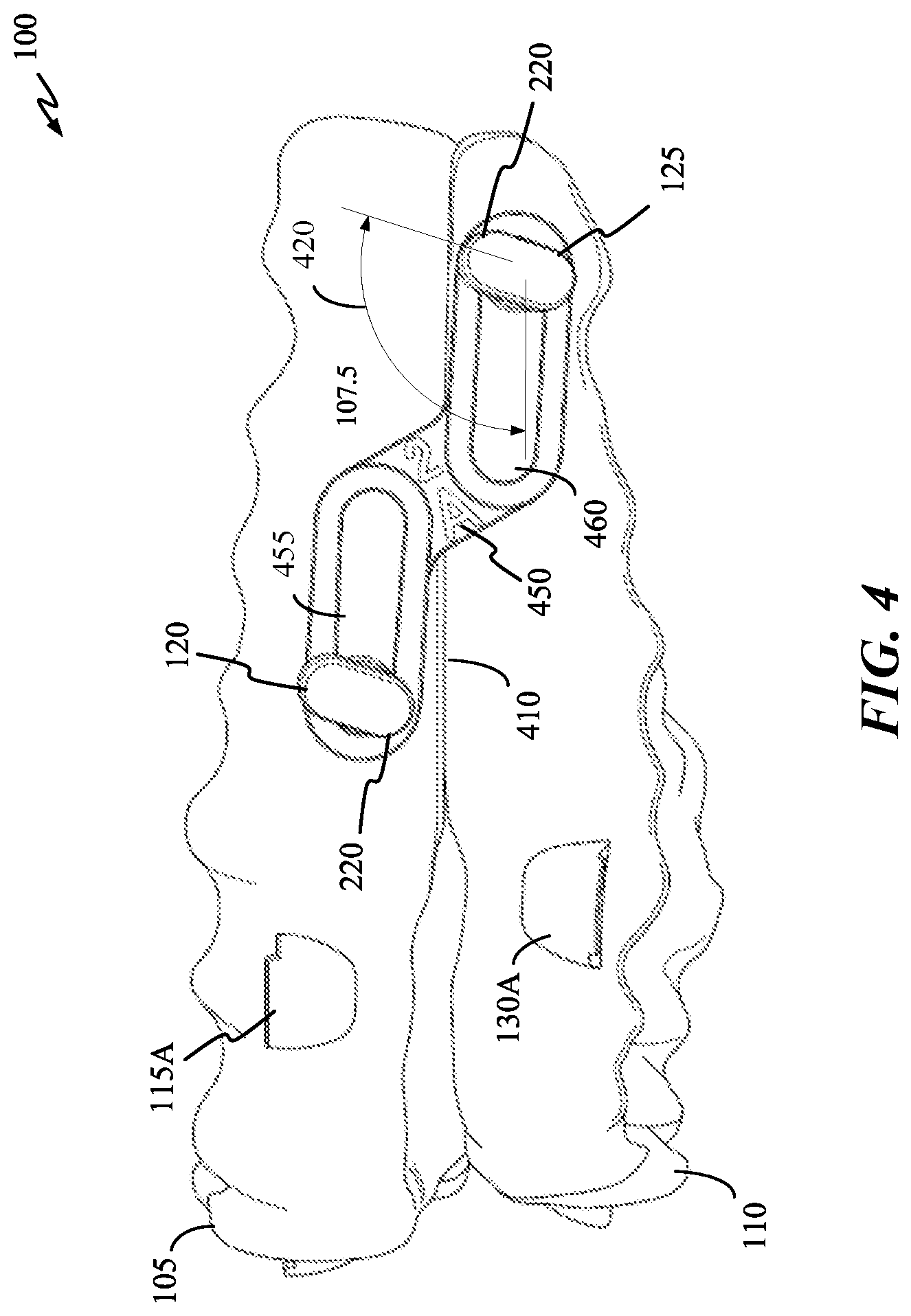 Patent US12616605 Figure 4 – Mandibular repositioning device