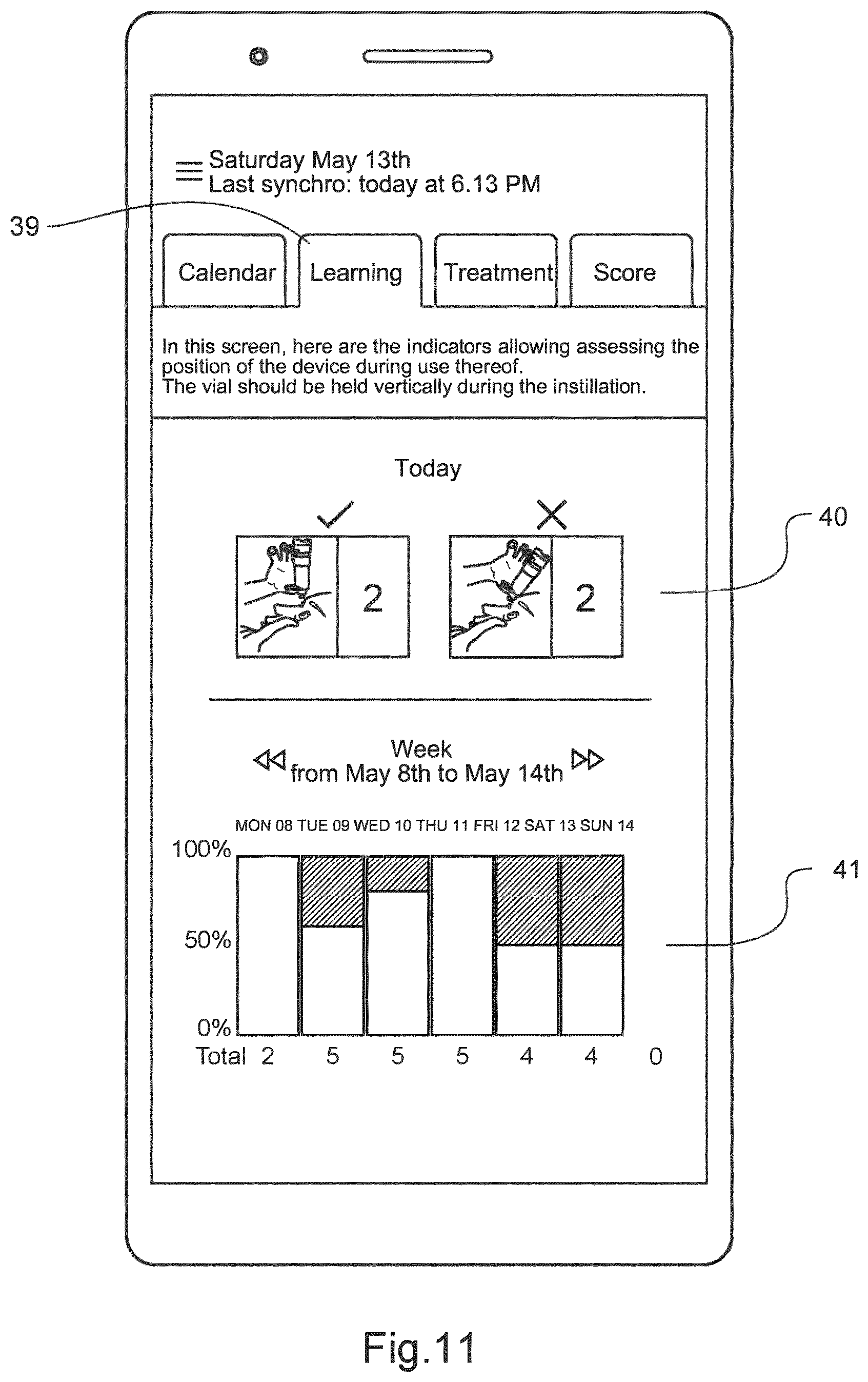 Patent US12616608 Figure 6 – Device and method for monitoring compliance with a therapeutic ophthalmic treatment
