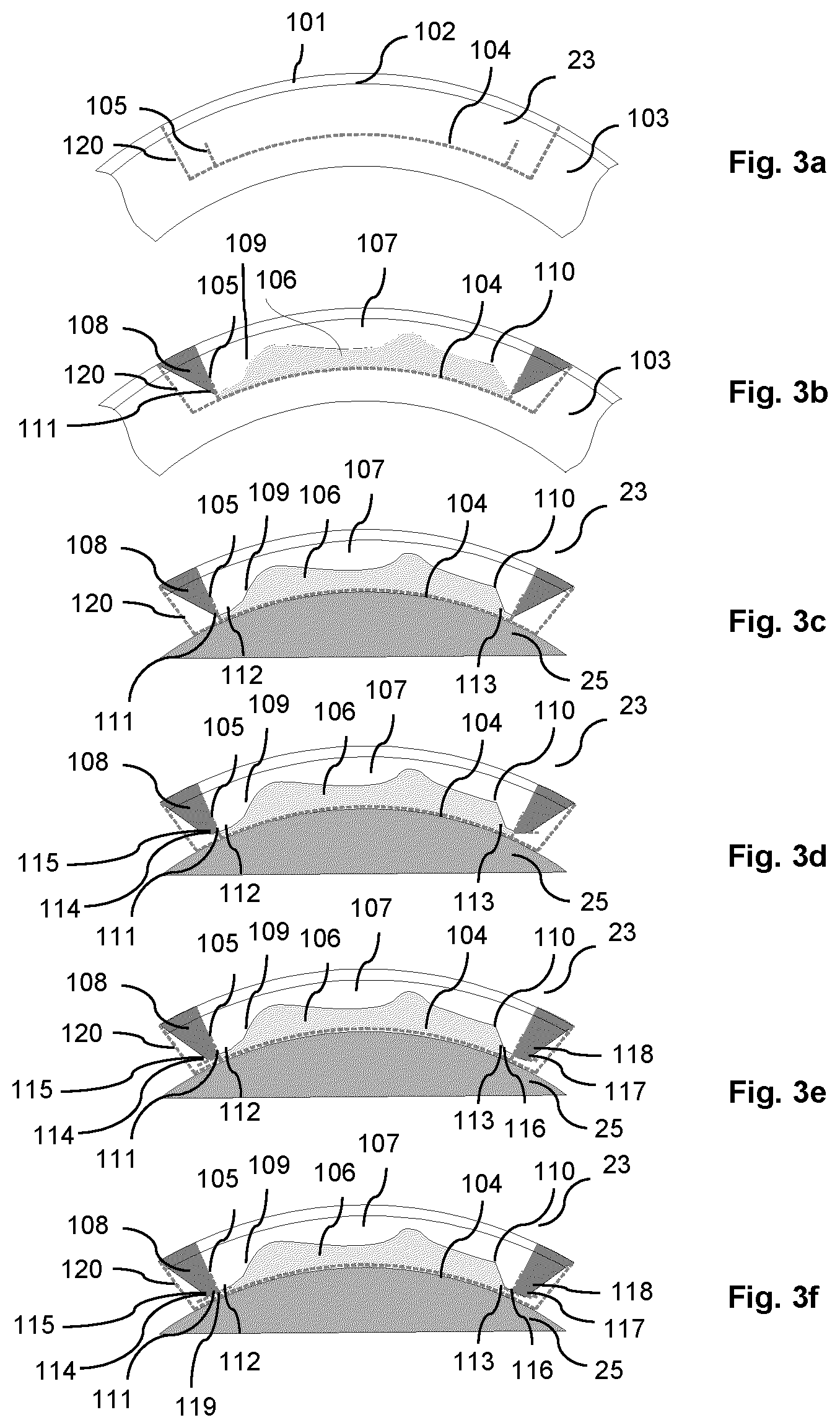 Patent US12616609 Figure 5 – Equipment and methods for refractive surgery, particularly for keratoplasty
