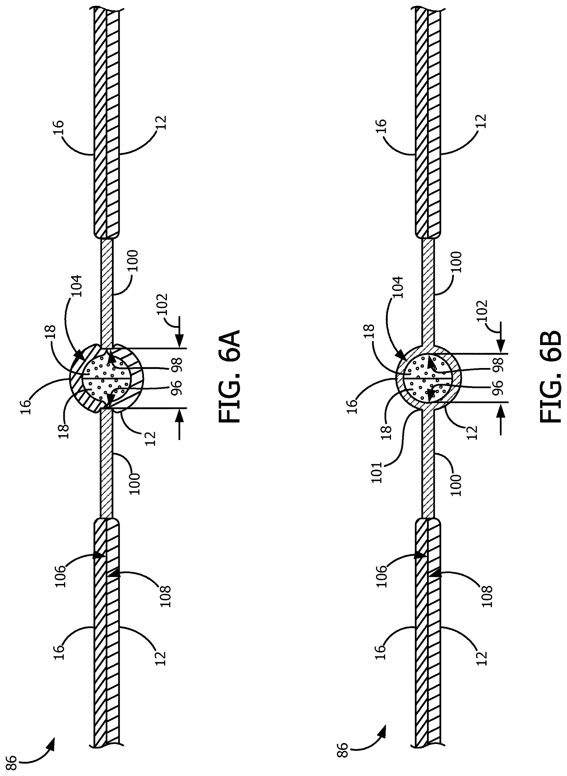 Patent US12616617 Figure 7 – Apparatus and method of manufacturing an elastic composite structure for an absorbent sanitary product