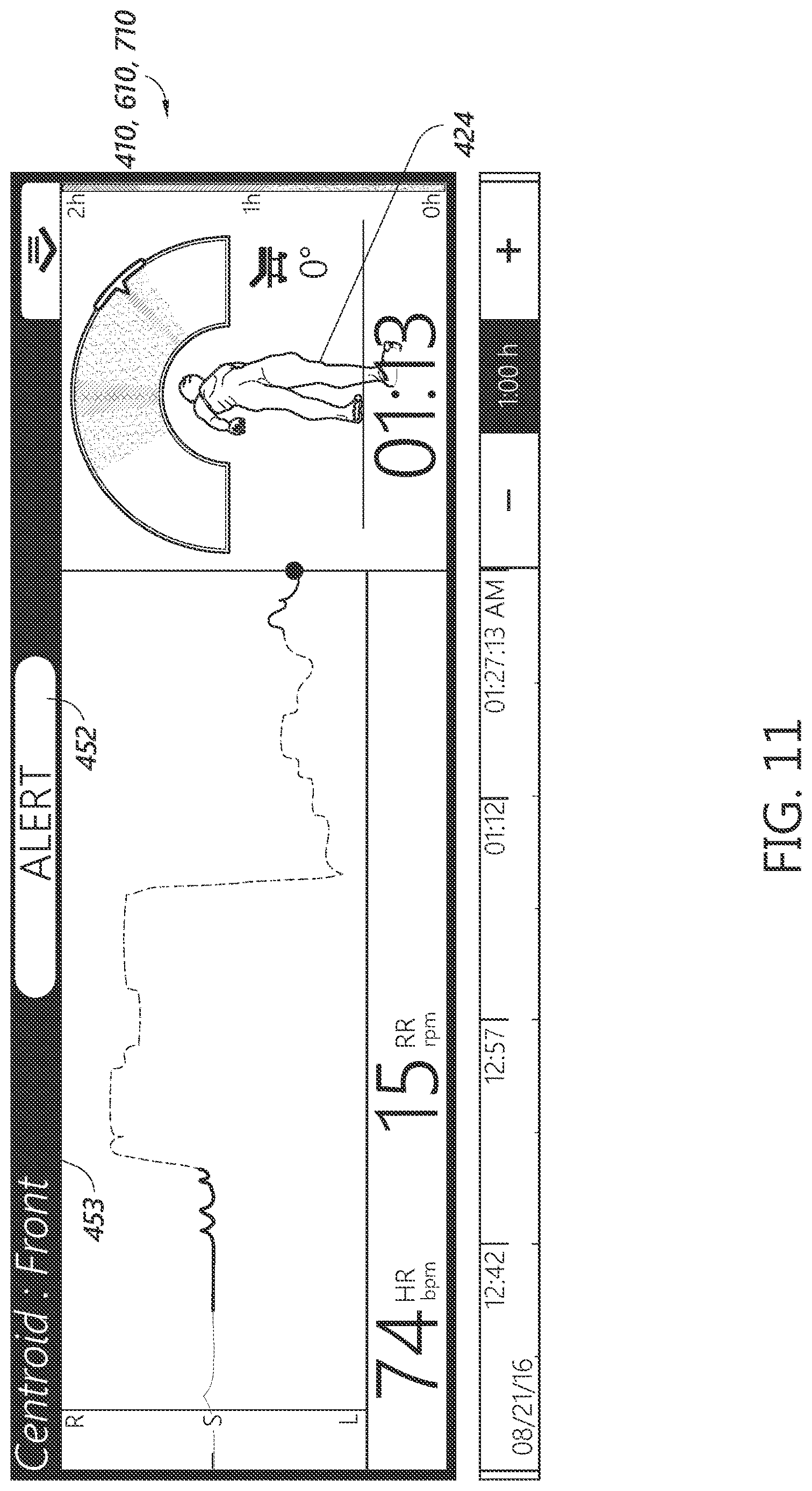Patent US12616623 Figure 16 – Patient monitoring device with improved user interface