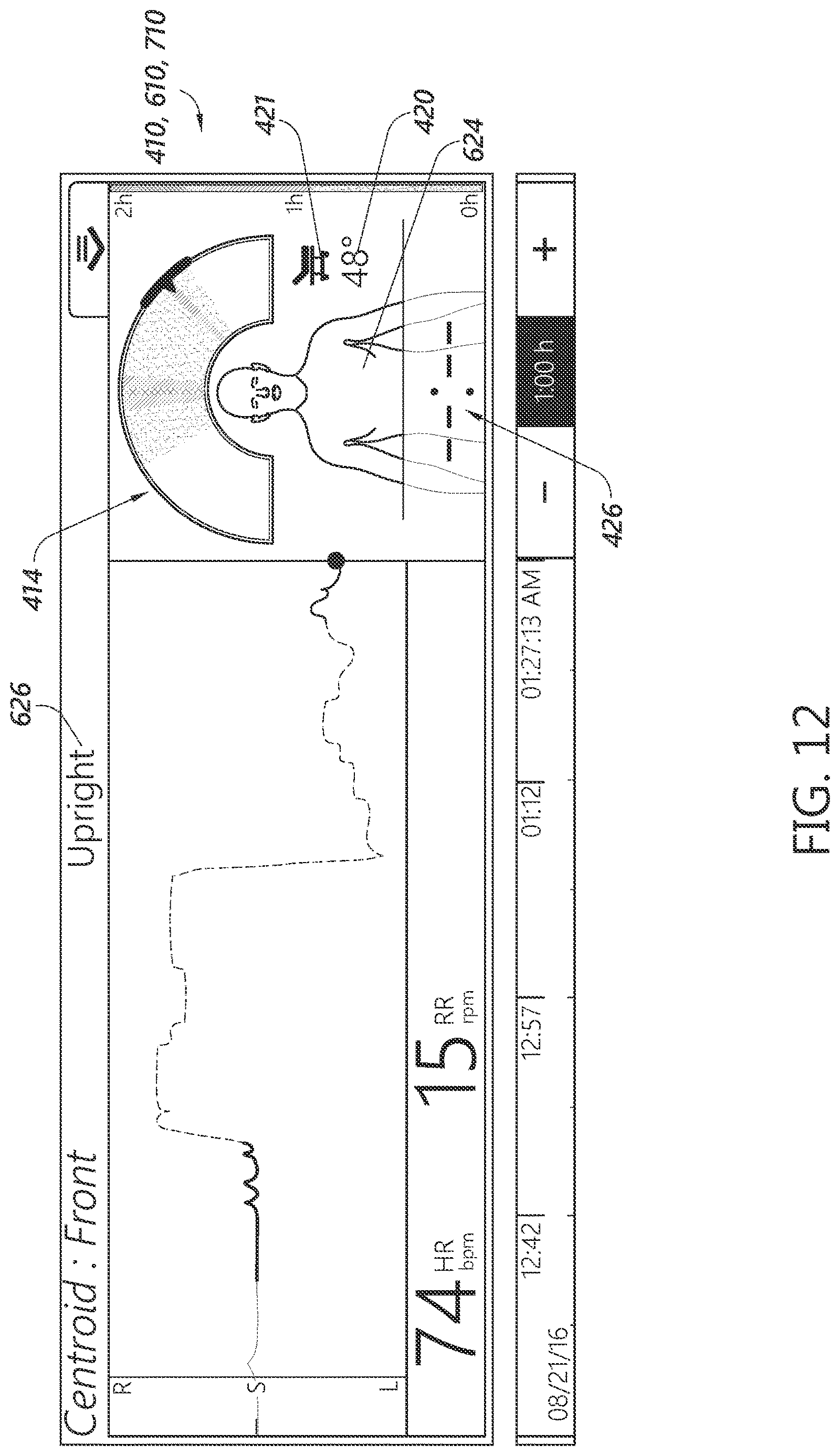 Patent US12616623 Figure 17 – Patient monitoring device with improved user interface