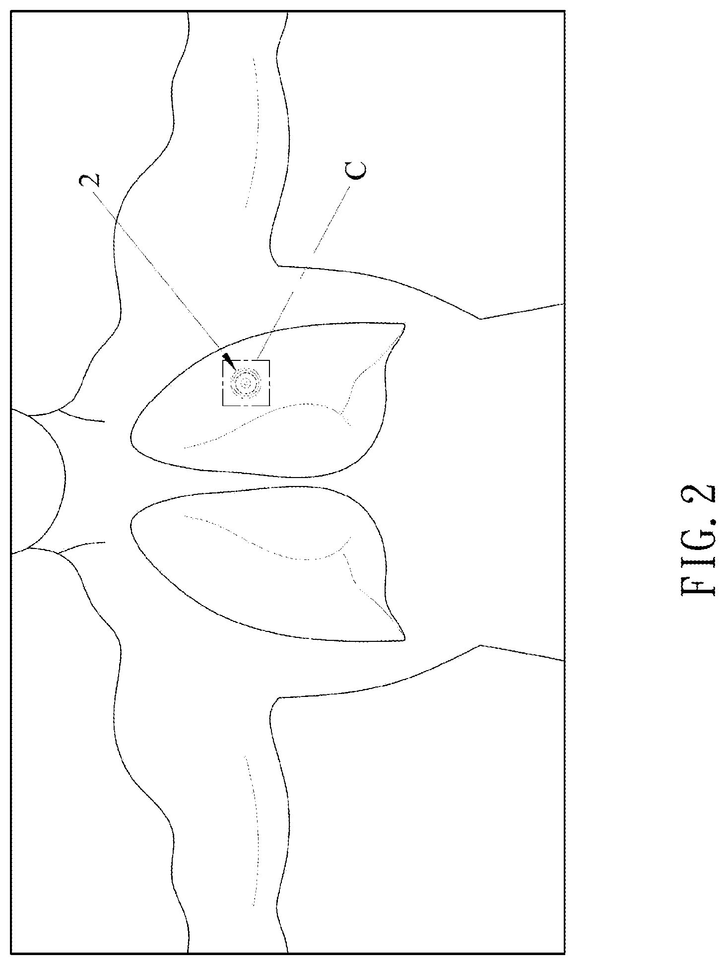 Patent US12616635 Figure 2 – Percussion apparatus for sputum clearance