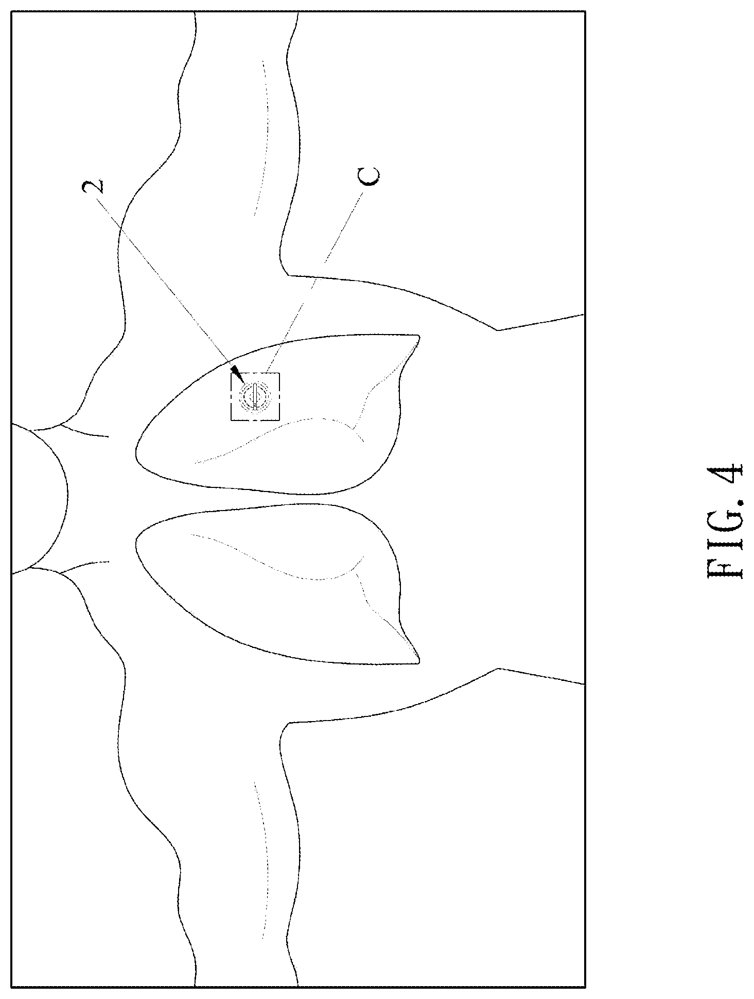 Patent US12616635 Figure 4 – Percussion apparatus for sputum clearance