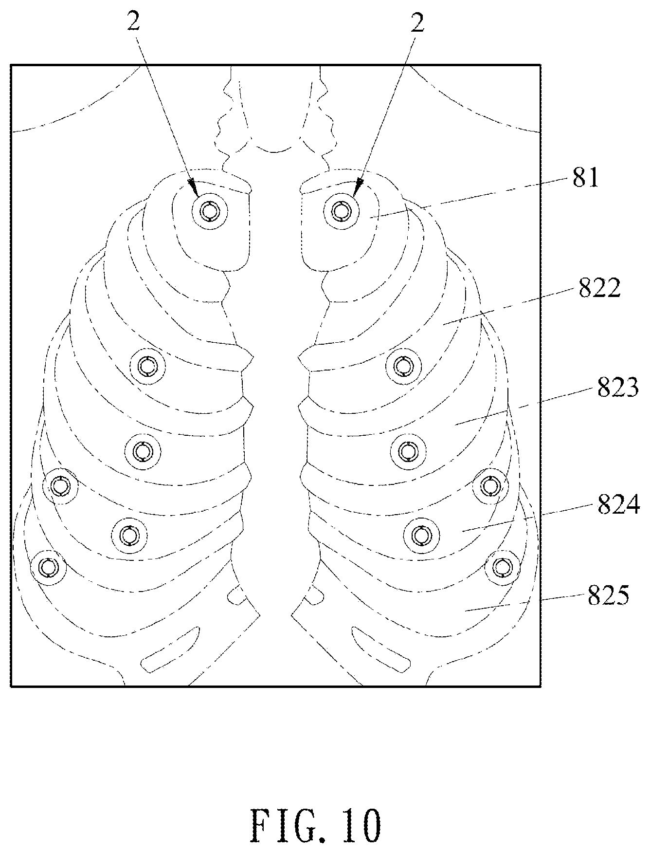 Patent US12616635 Figure 10 – Percussion apparatus for sputum clearance