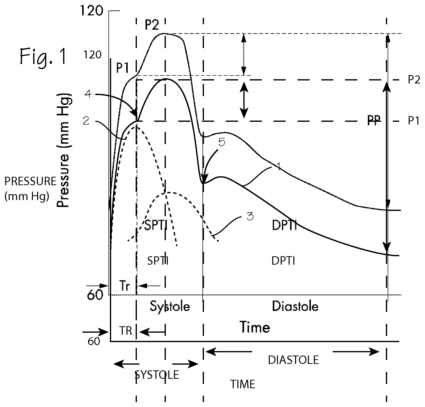 Patent US12616637 — CPR chest compression system with tonometric input and feedback — Figure 1