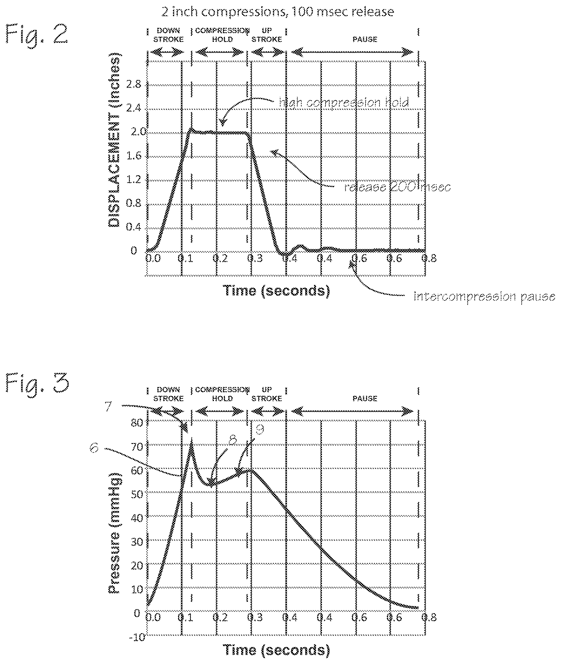 Patent US12616637 Figure 2 – CPR chest compression system with tonometric input and feedback