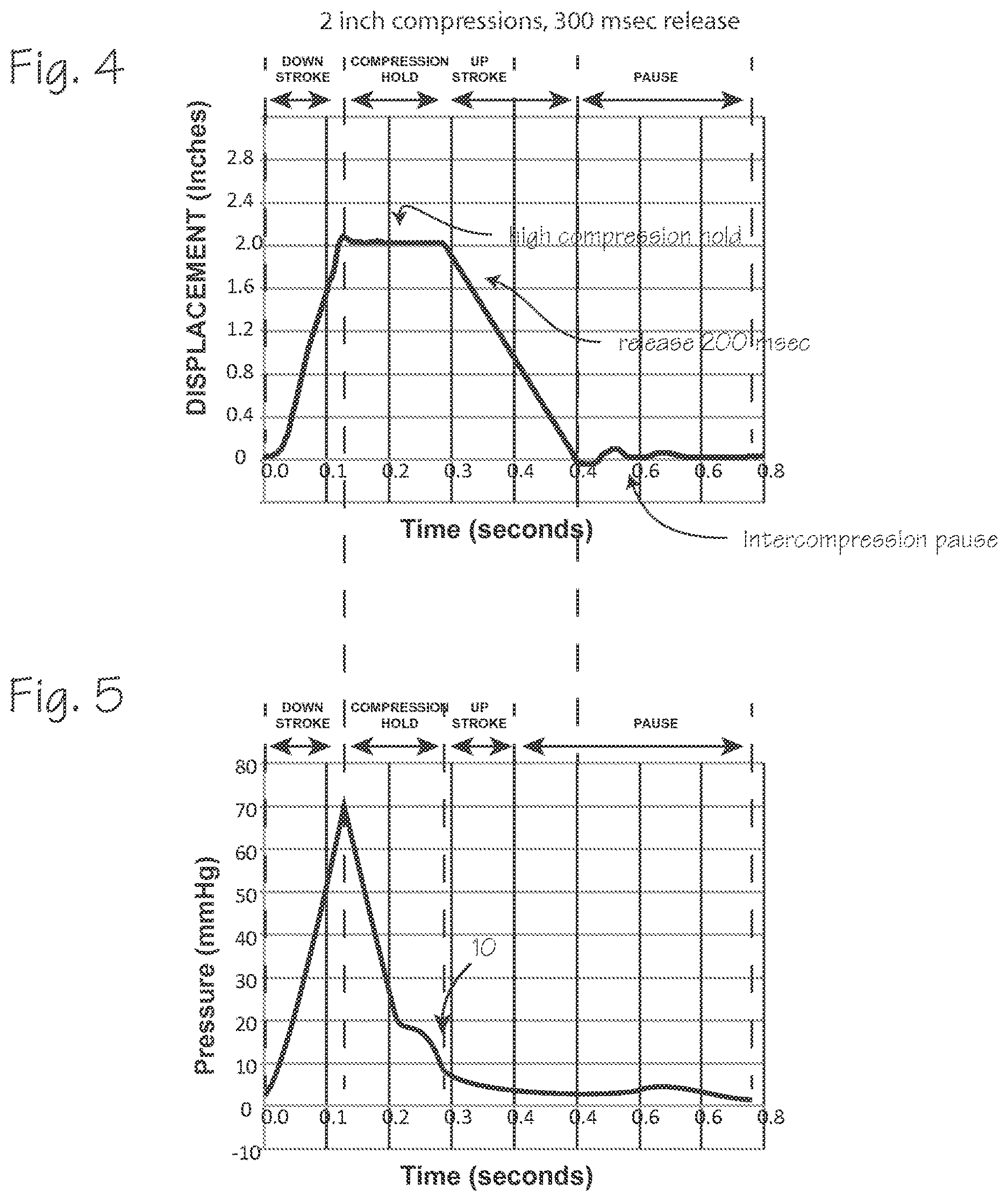 Patent US12616637 Figure 3 – CPR chest compression system with tonometric input and feedback
