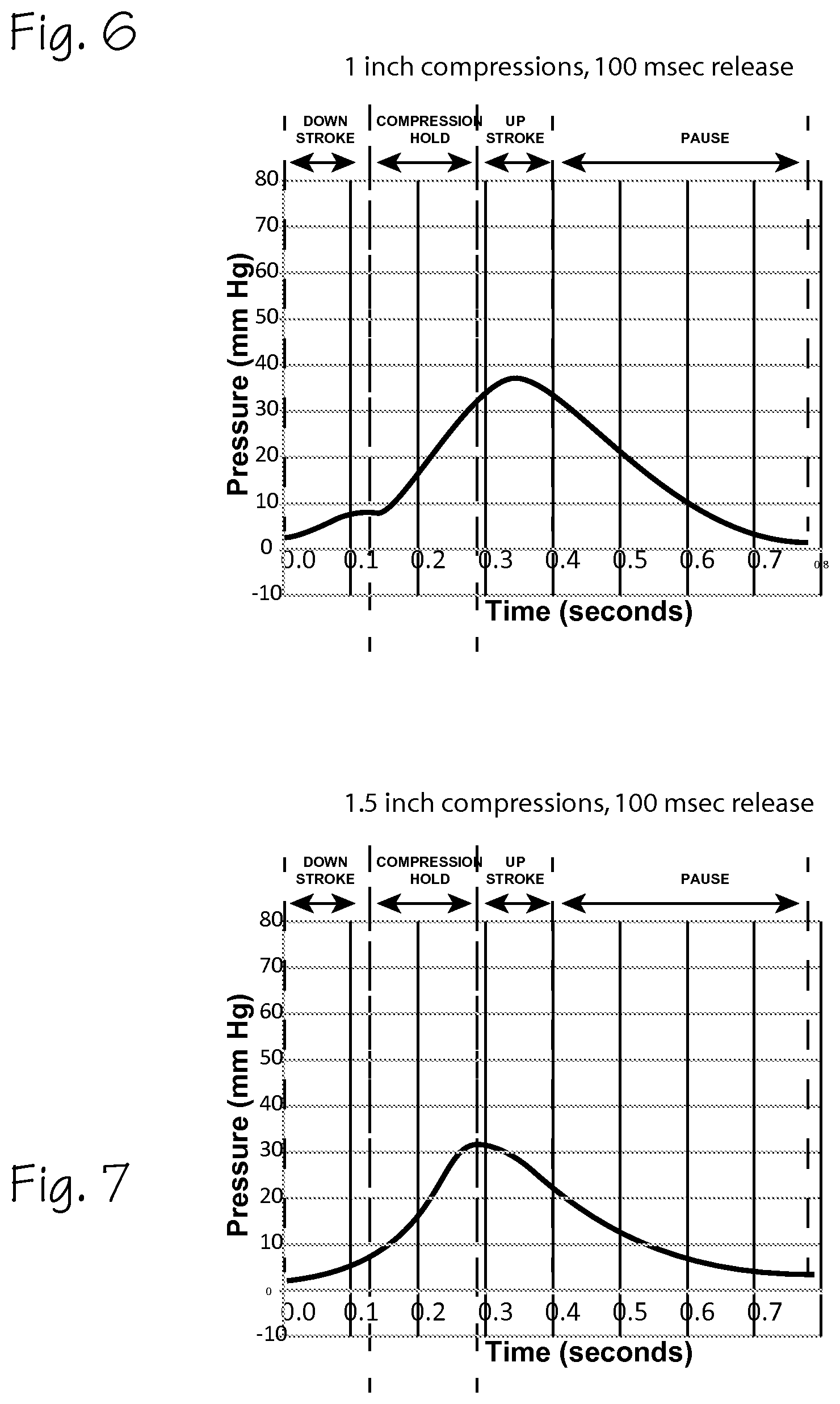 Patent US12616637 Figure 4 – CPR chest compression system with tonometric input and feedback