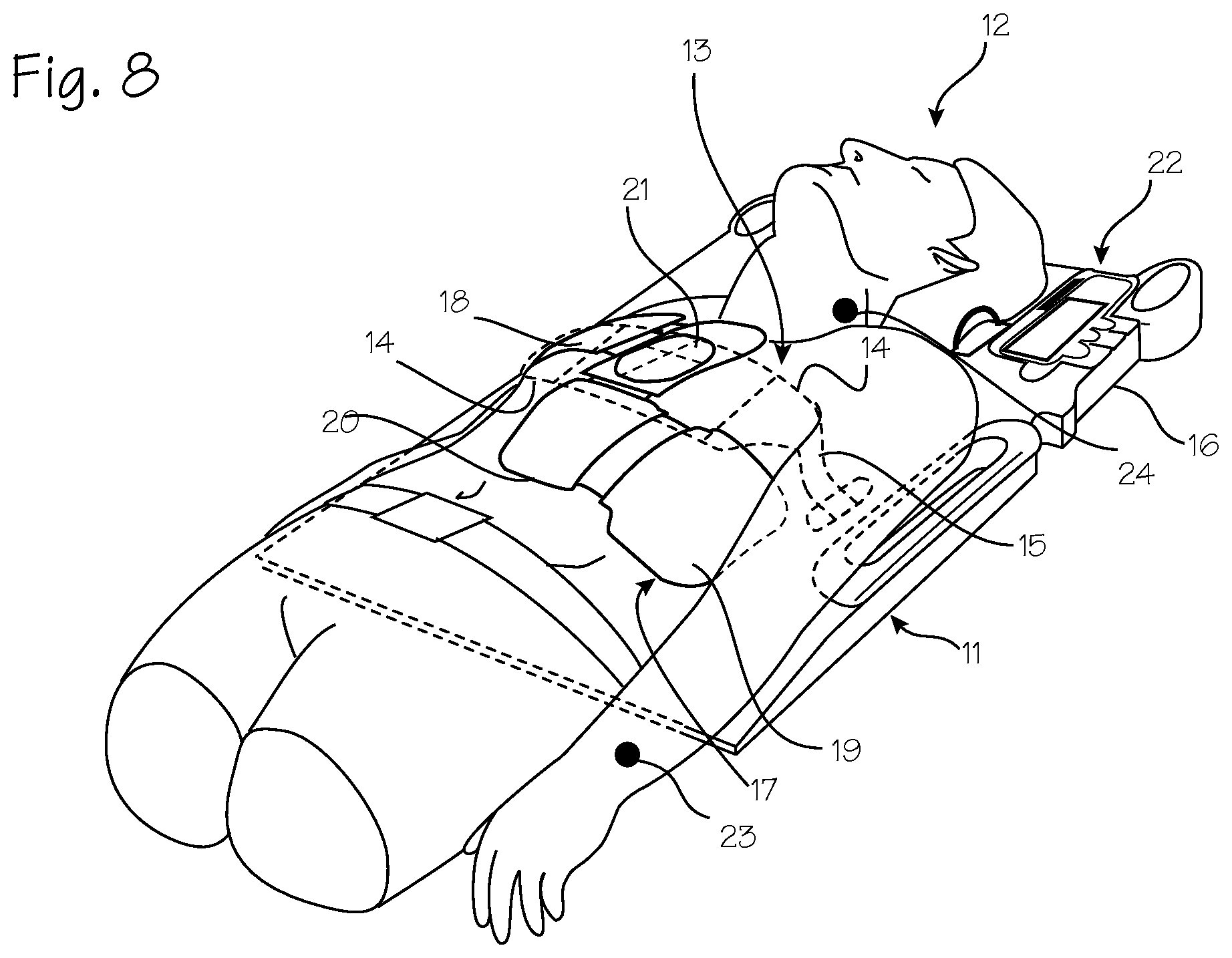 Patent US12616637 Figure 5 – CPR chest compression system with tonometric input and feedback