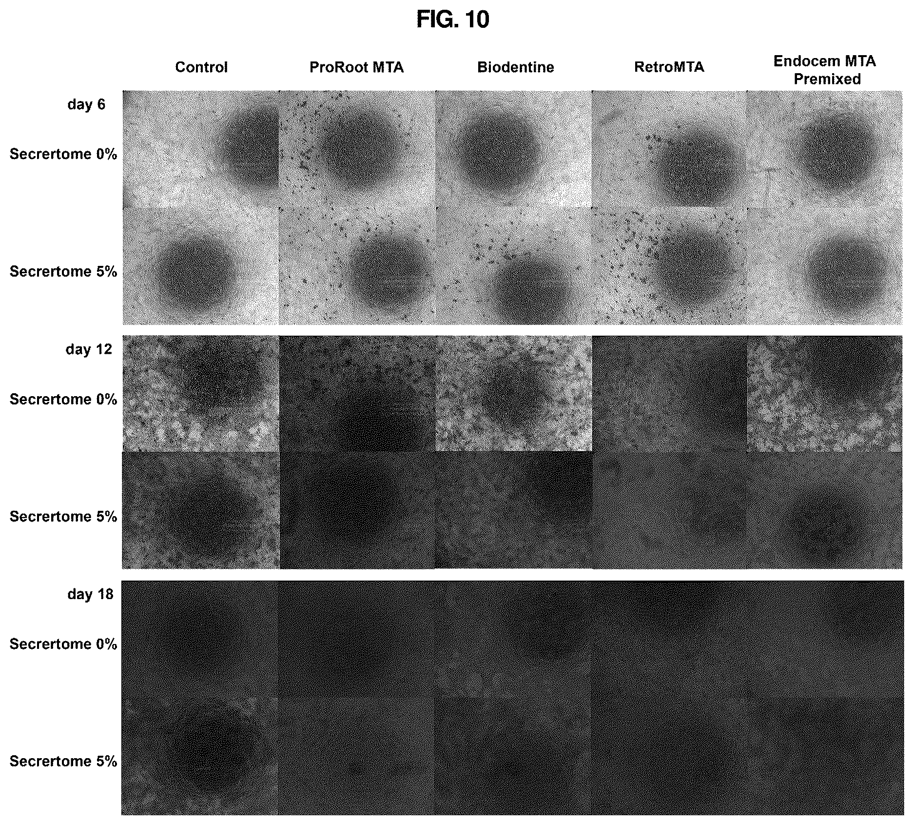 Patent US12616643 Figure 10 – Method of preparing new biomaterials for dental pulp regeneration and a composition of new biomaterials prepared accordingly