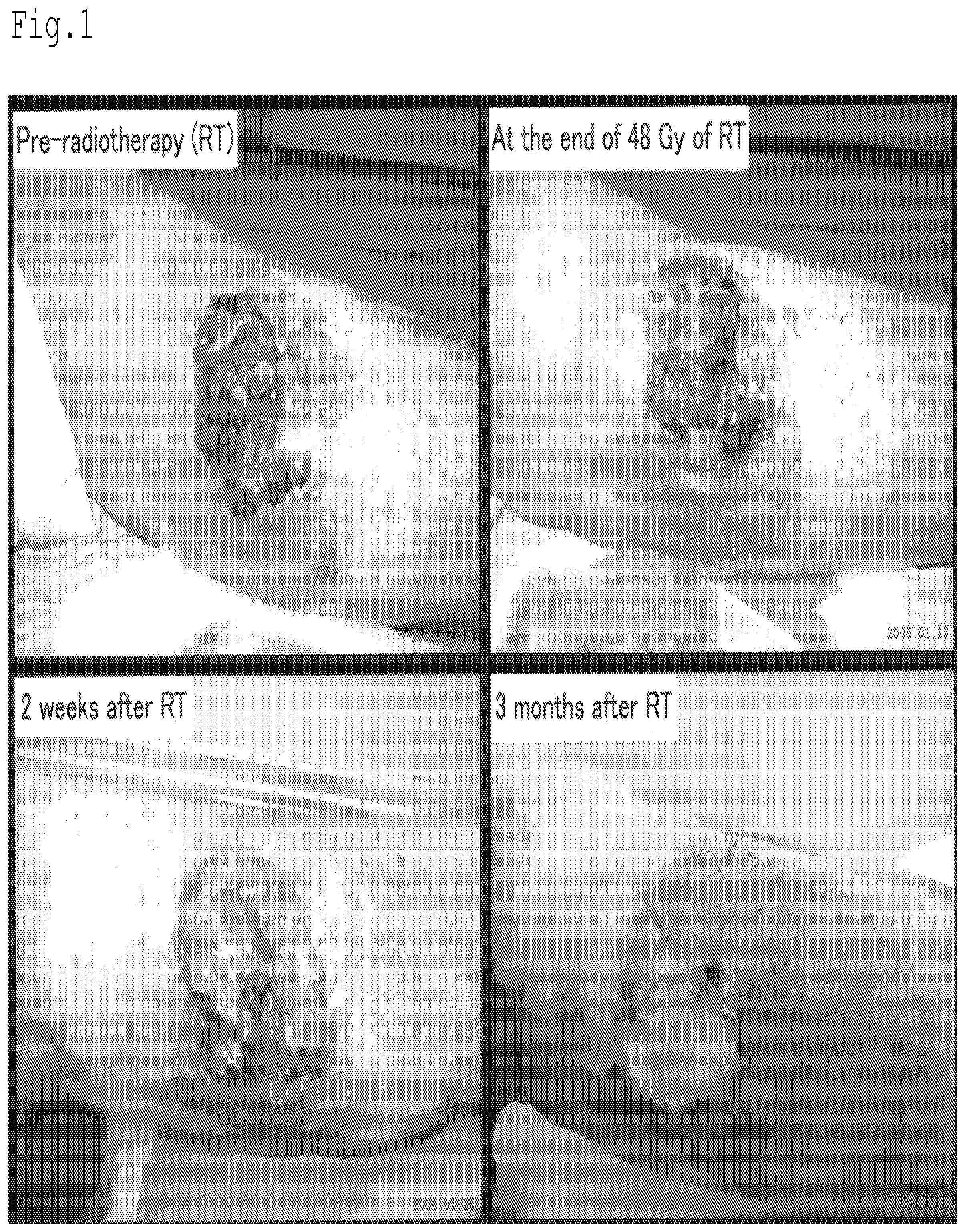 Patent US12616650 Figure 1 – Radiation sensitizer of anti-cancer chemotherapy sensitizer