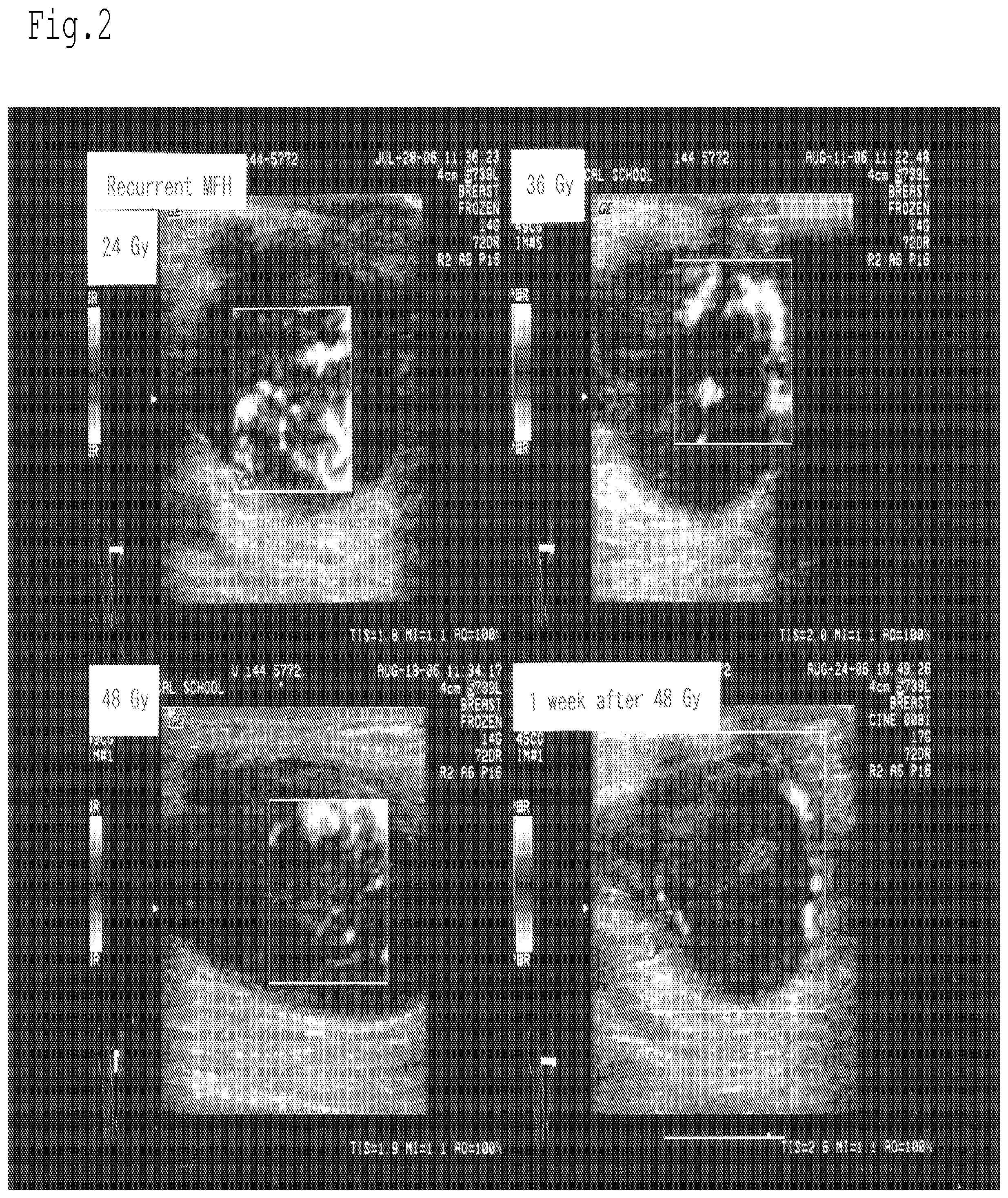 Patent US12616650 Figure 2 – Radiation sensitizer of anti-cancer chemotherapy sensitizer
