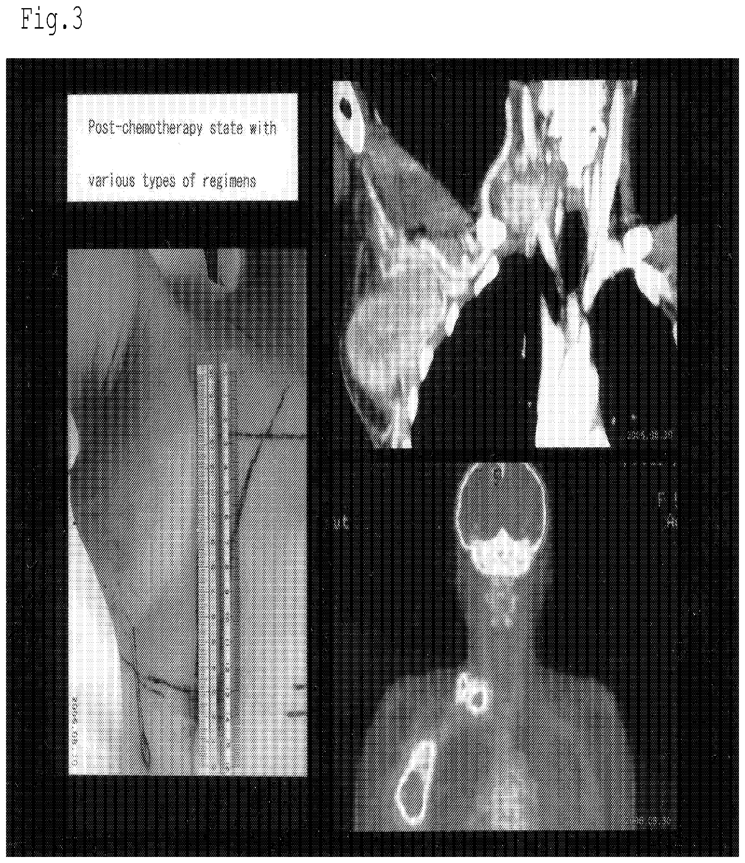 Patent US12616650 Figure 3 – Radiation sensitizer of anti-cancer chemotherapy sensitizer
