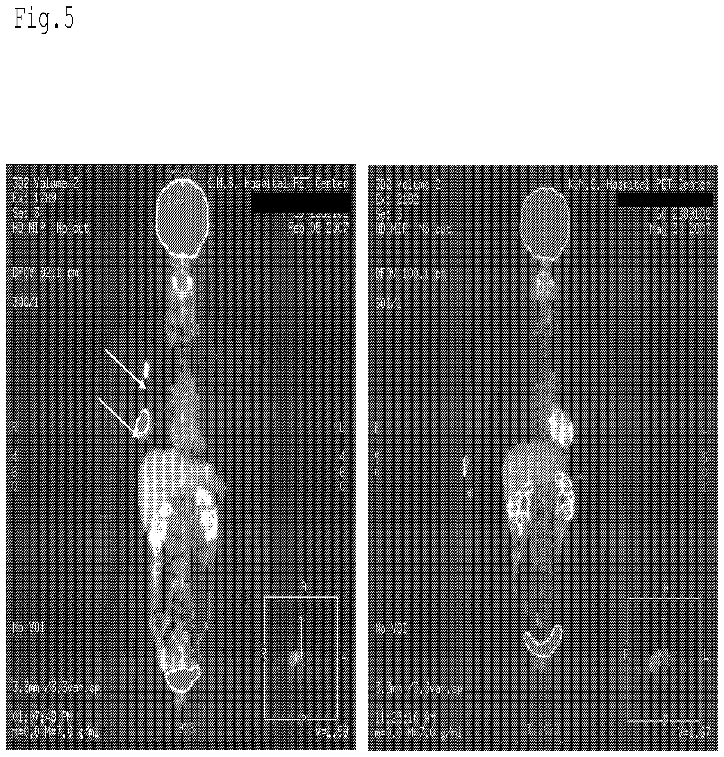 Patent US12616650 Figure 5 – Radiation sensitizer of anti-cancer chemotherapy sensitizer