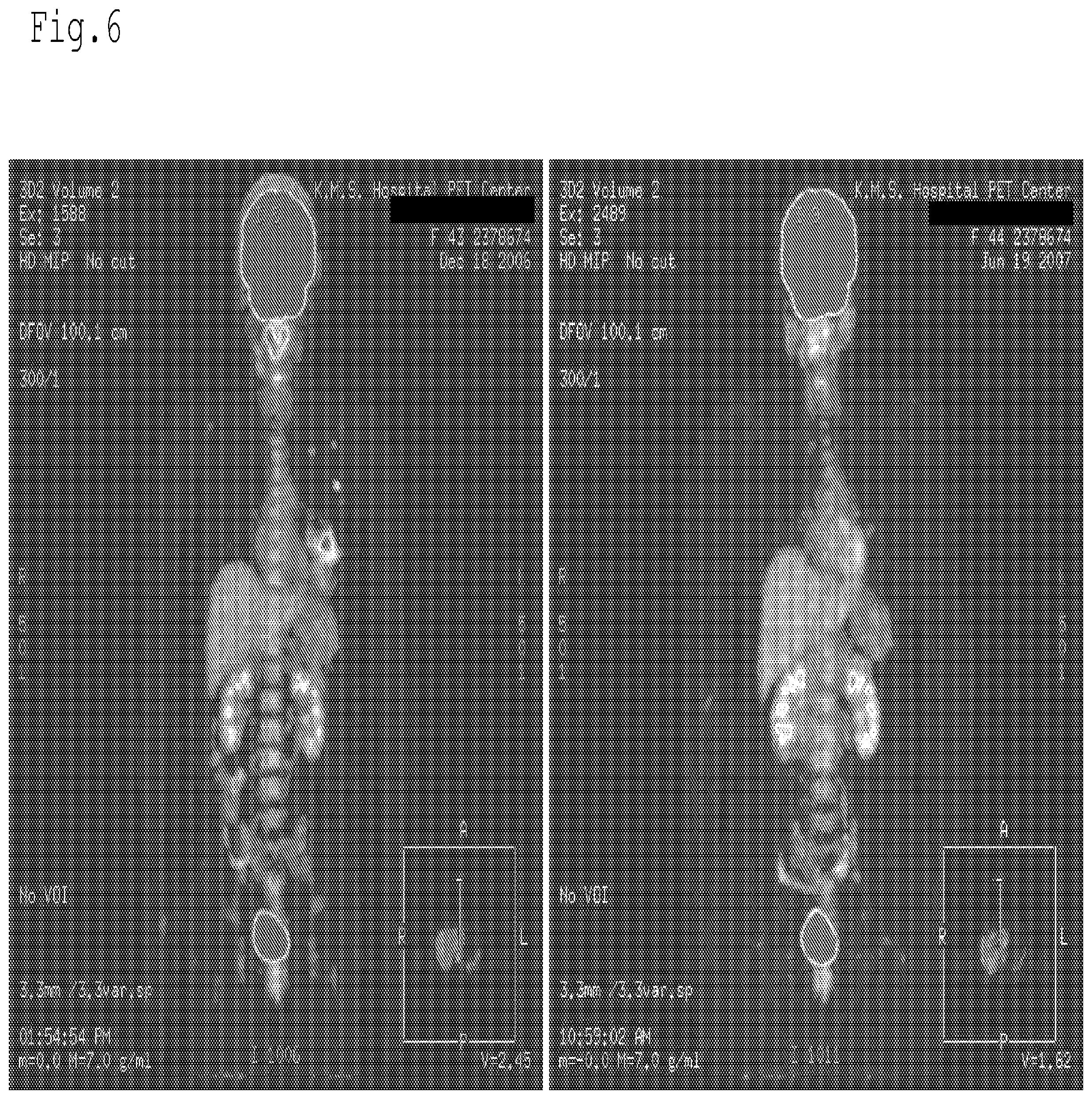 Patent US12616650 Figure 6 – Radiation sensitizer of anti-cancer chemotherapy sensitizer
