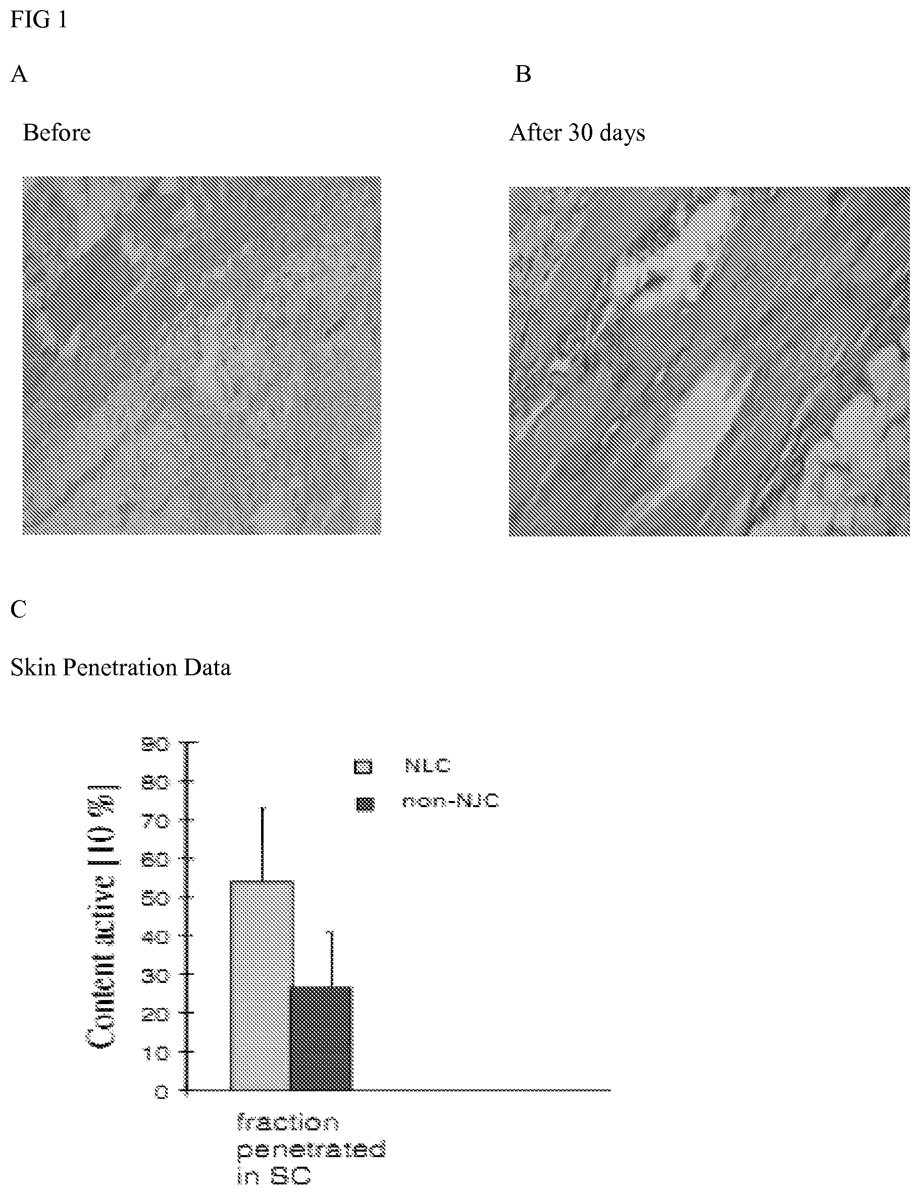 Patent US12616651 Figure 1 – Topical lipolysis composition and methods