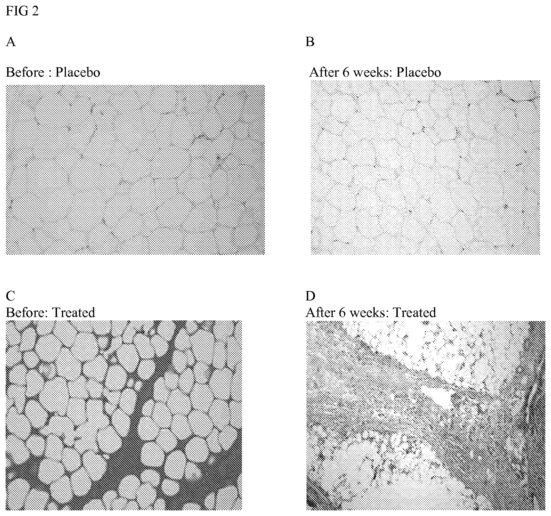 Patent US12616651 Figure 2 – Topical lipolysis composition and methods