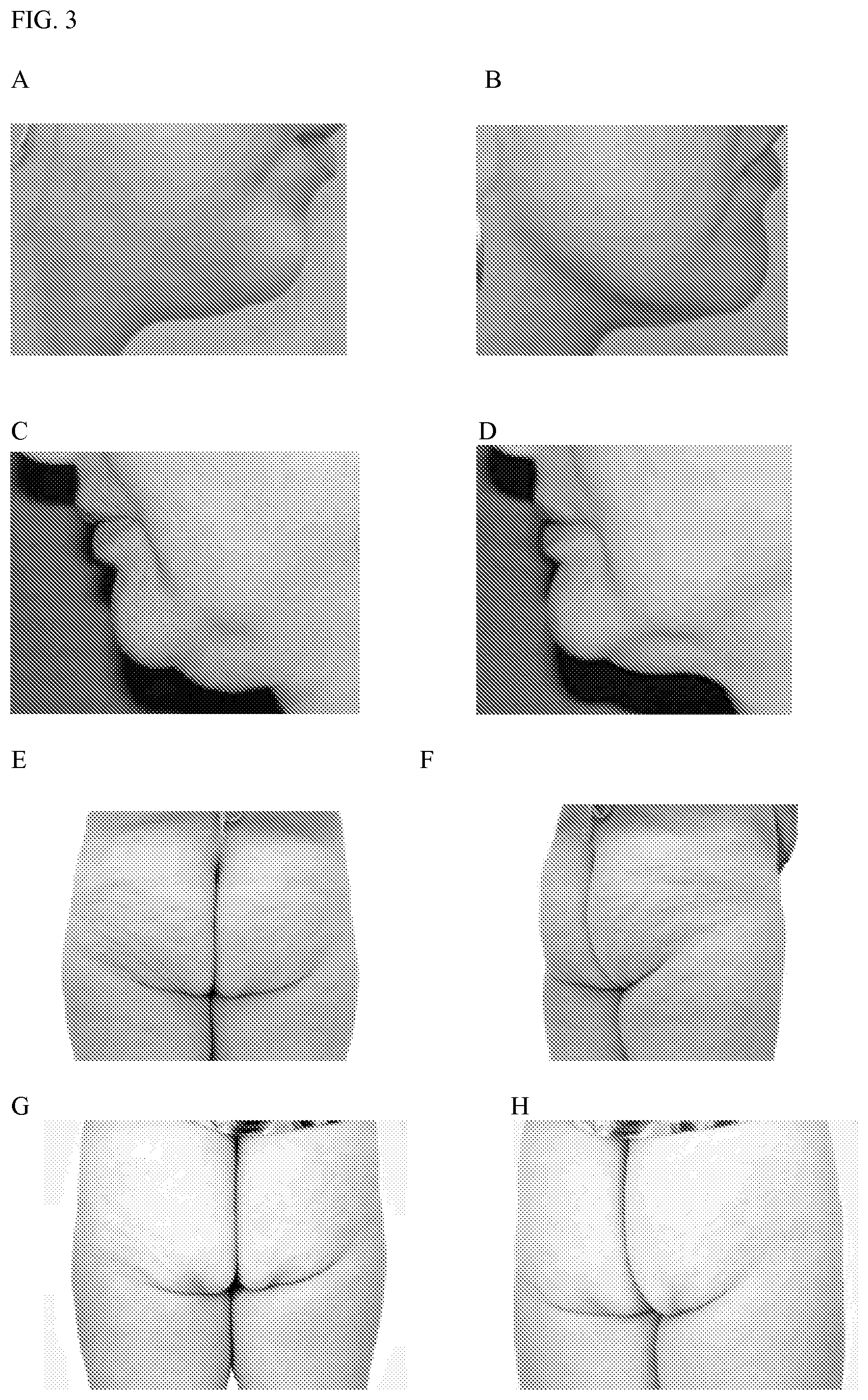 Patent US12616651 Figure 3 – Topical lipolysis composition and methods