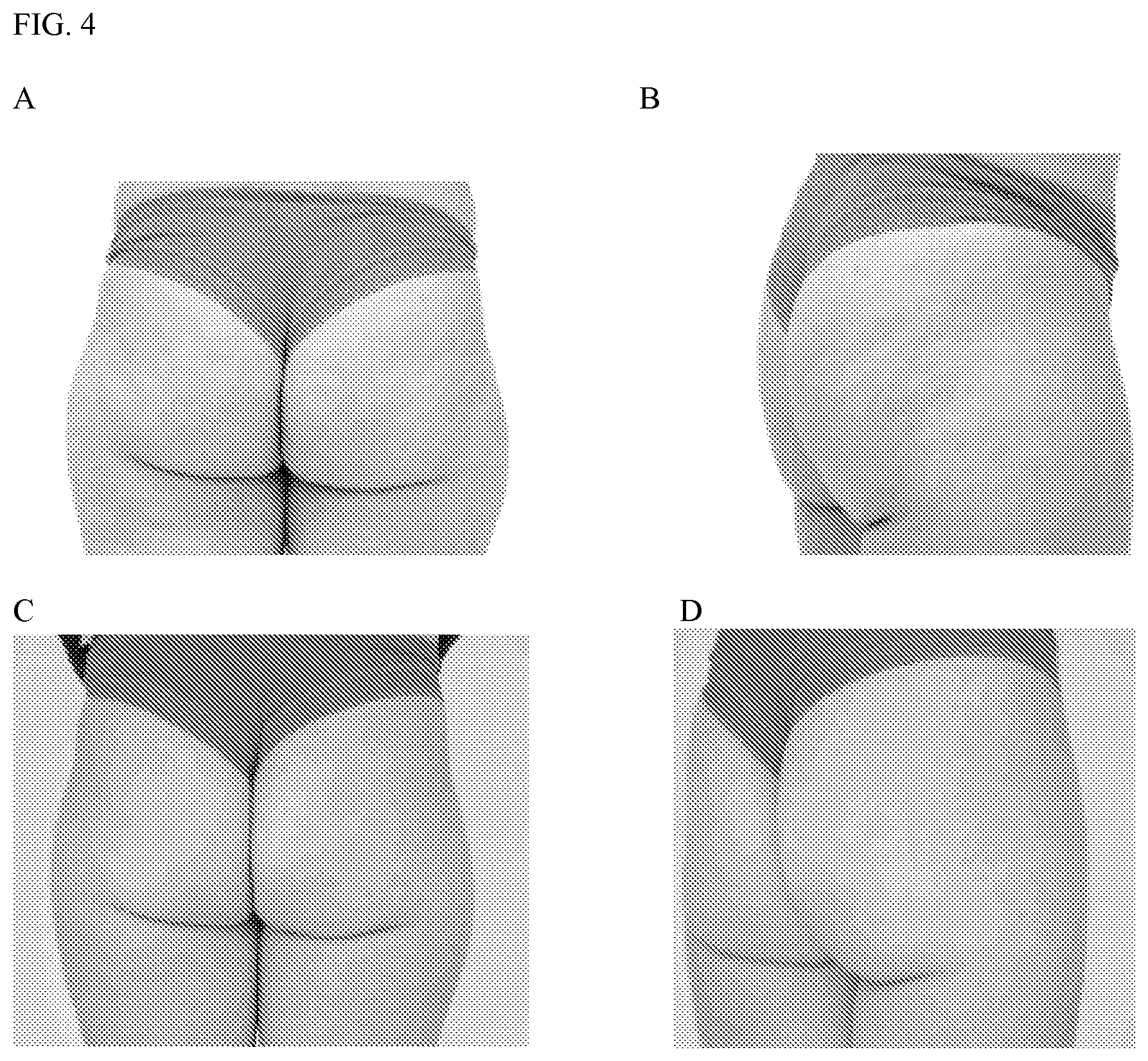 Patent US12616651 Figure 4 – Topical lipolysis composition and methods