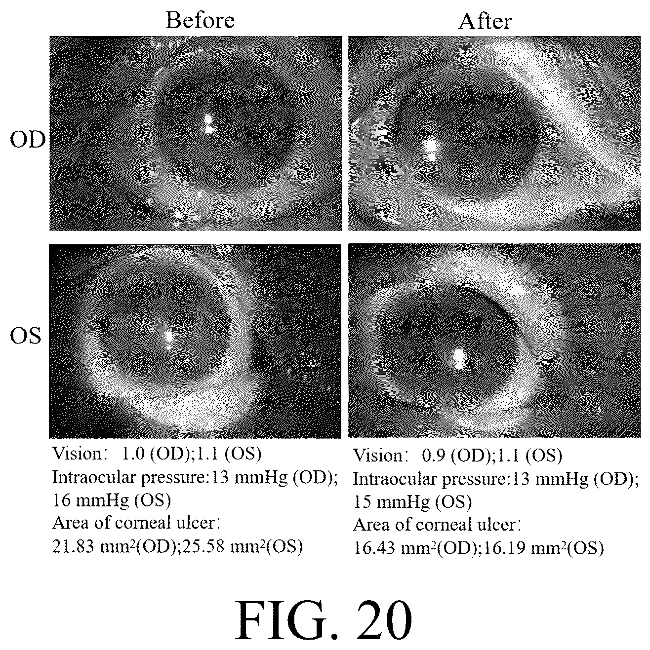Patent US12616652 Figure 12 – Lenses for treating ocular diseases and preparation method thereof