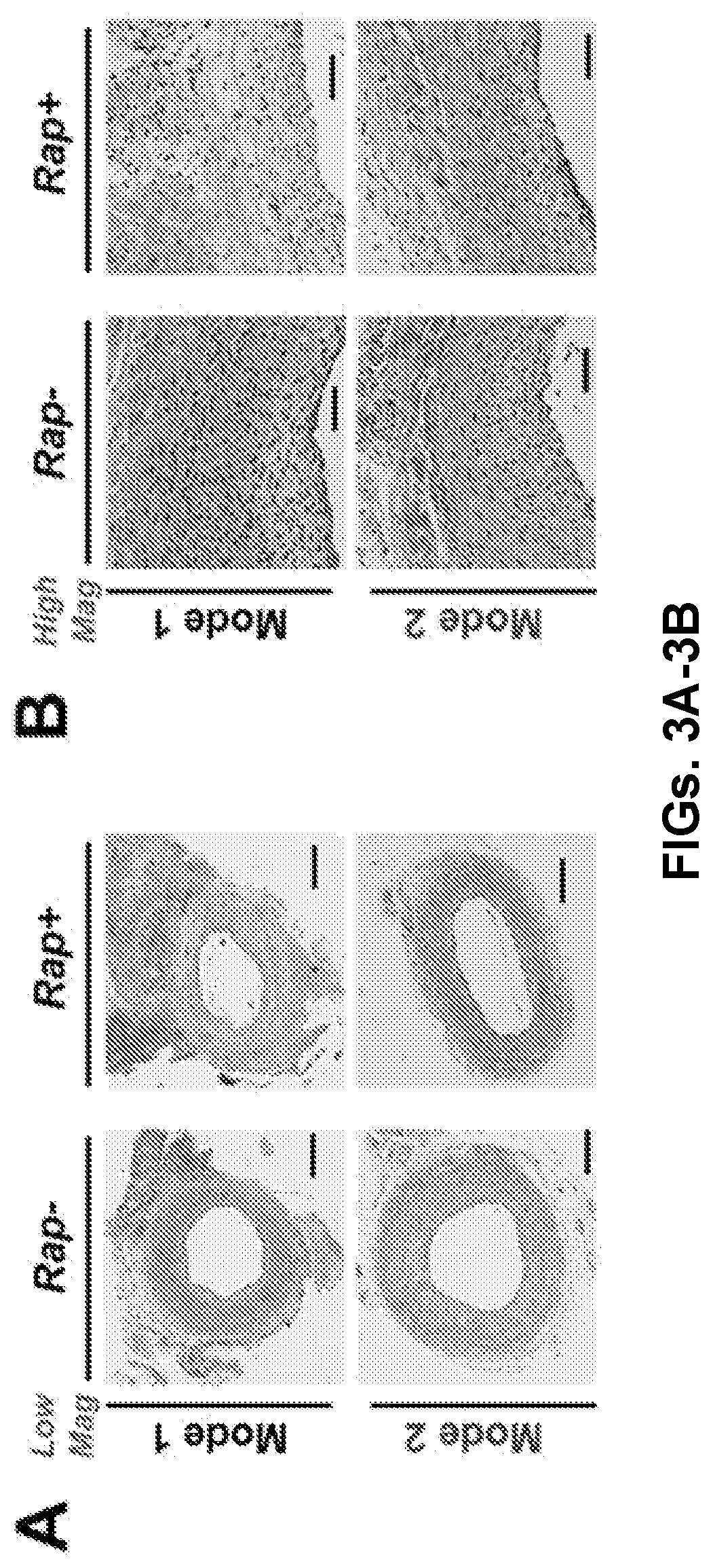 Patent US12616656 Figure 4 – Adventitial painting modality of local drug delivery to abate intimal hyperplasia