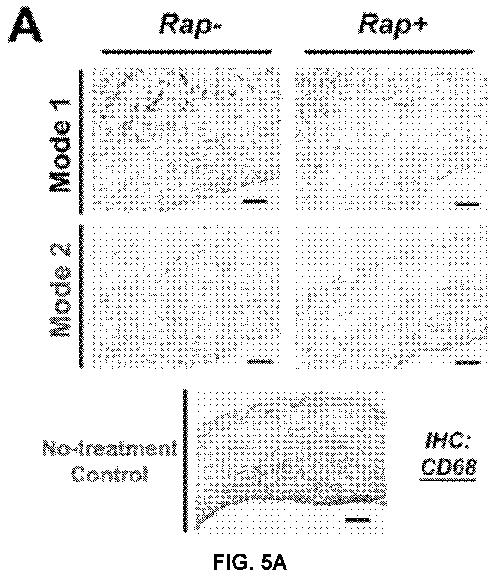 Patent US12616656 Figure 7 – Adventitial painting modality of local drug delivery to abate intimal hyperplasia