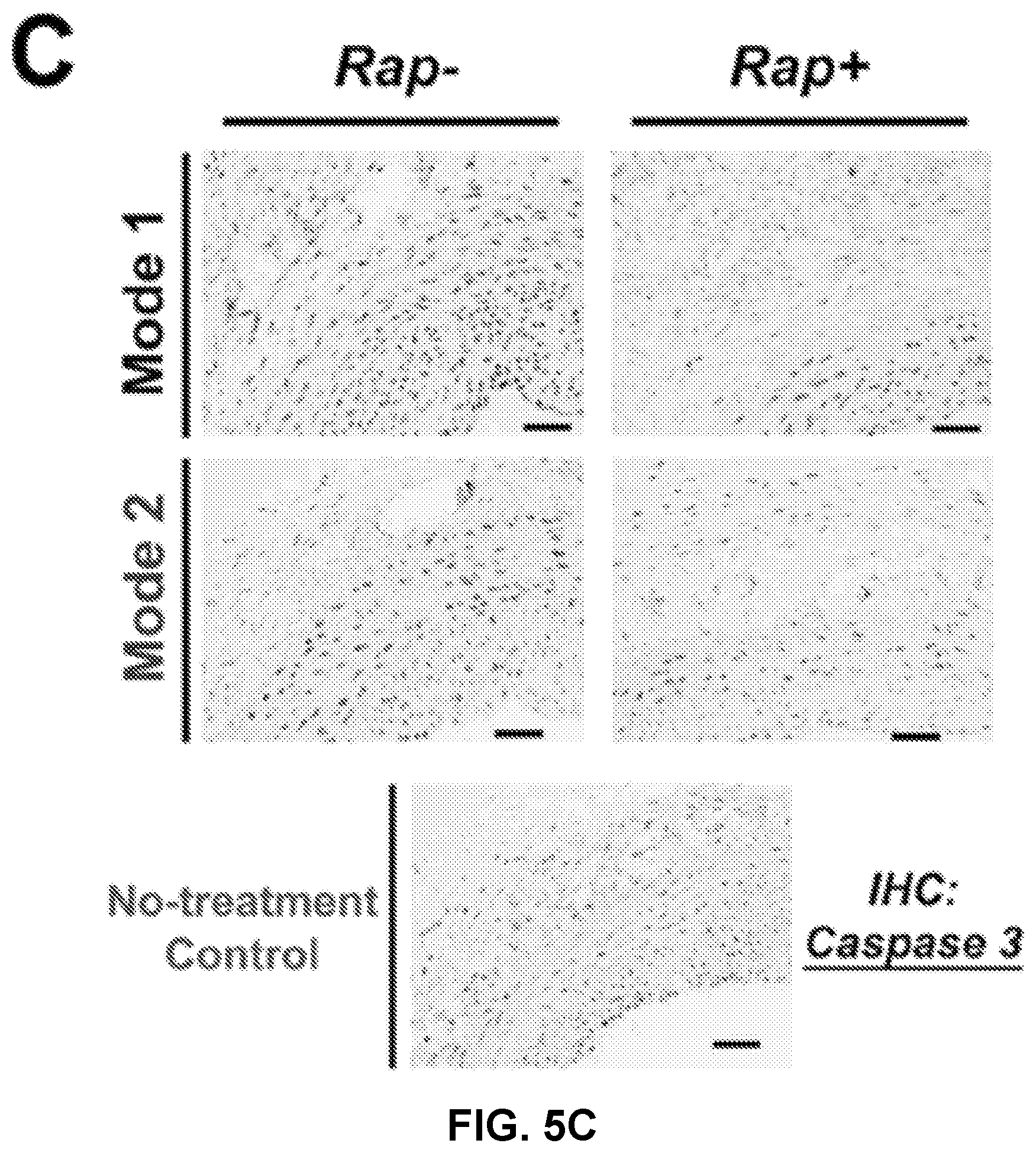Patent US12616656 Figure 9 – Adventitial painting modality of local drug delivery to abate intimal hyperplasia