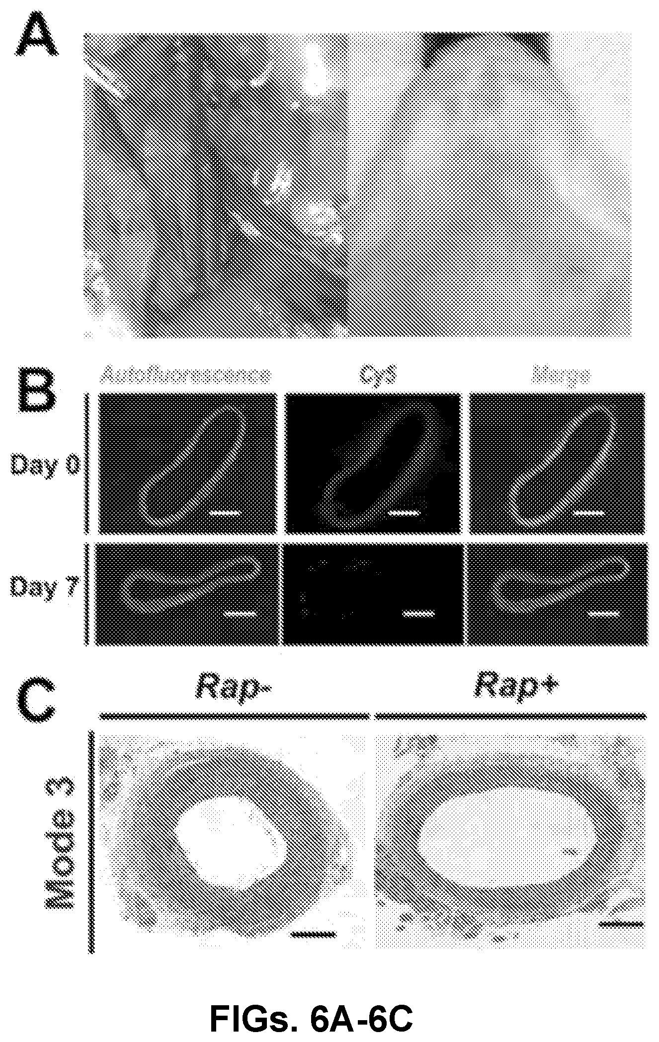 Patent US12616656 Figure 11 – Adventitial painting modality of local drug delivery to abate intimal hyperplasia
