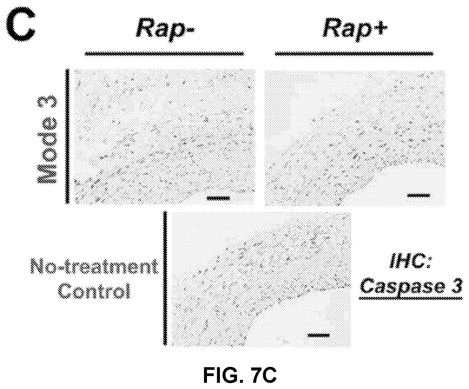 Patent US12616656 Figure 15 – Adventitial painting modality of local drug delivery to abate intimal hyperplasia