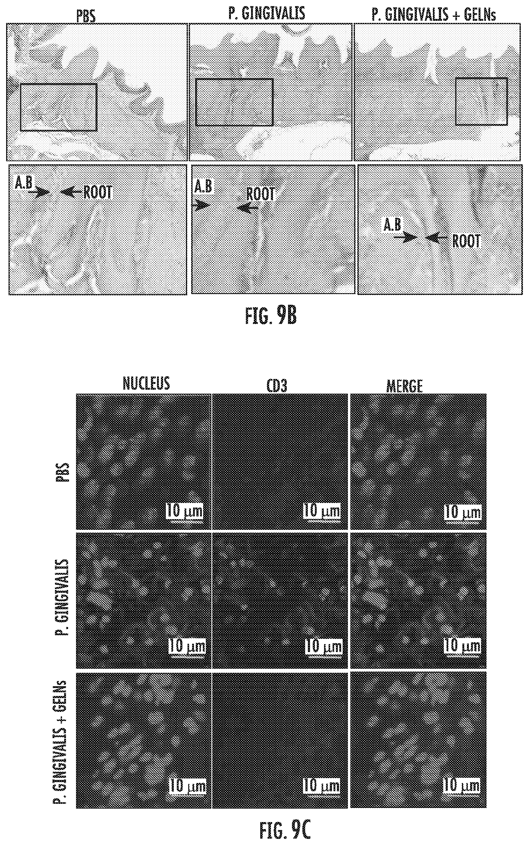 Patent US12616663 Figure 14 – Plant-derived exosome-like nanoparticles inhibit bacterial pathogenicity