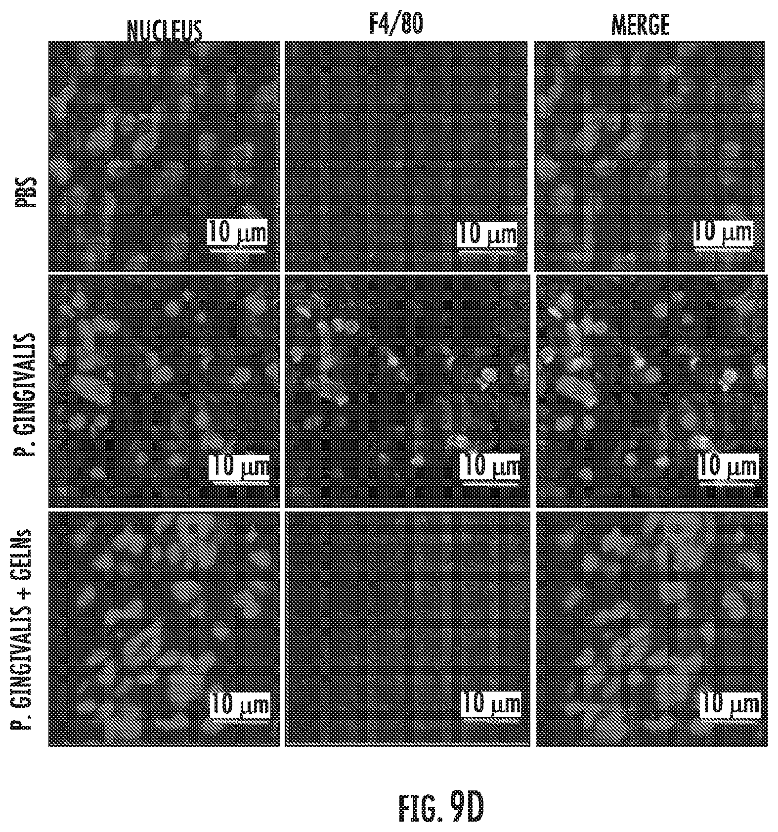 Patent US12616663 Figure 15 – Plant-derived exosome-like nanoparticles inhibit bacterial pathogenicity