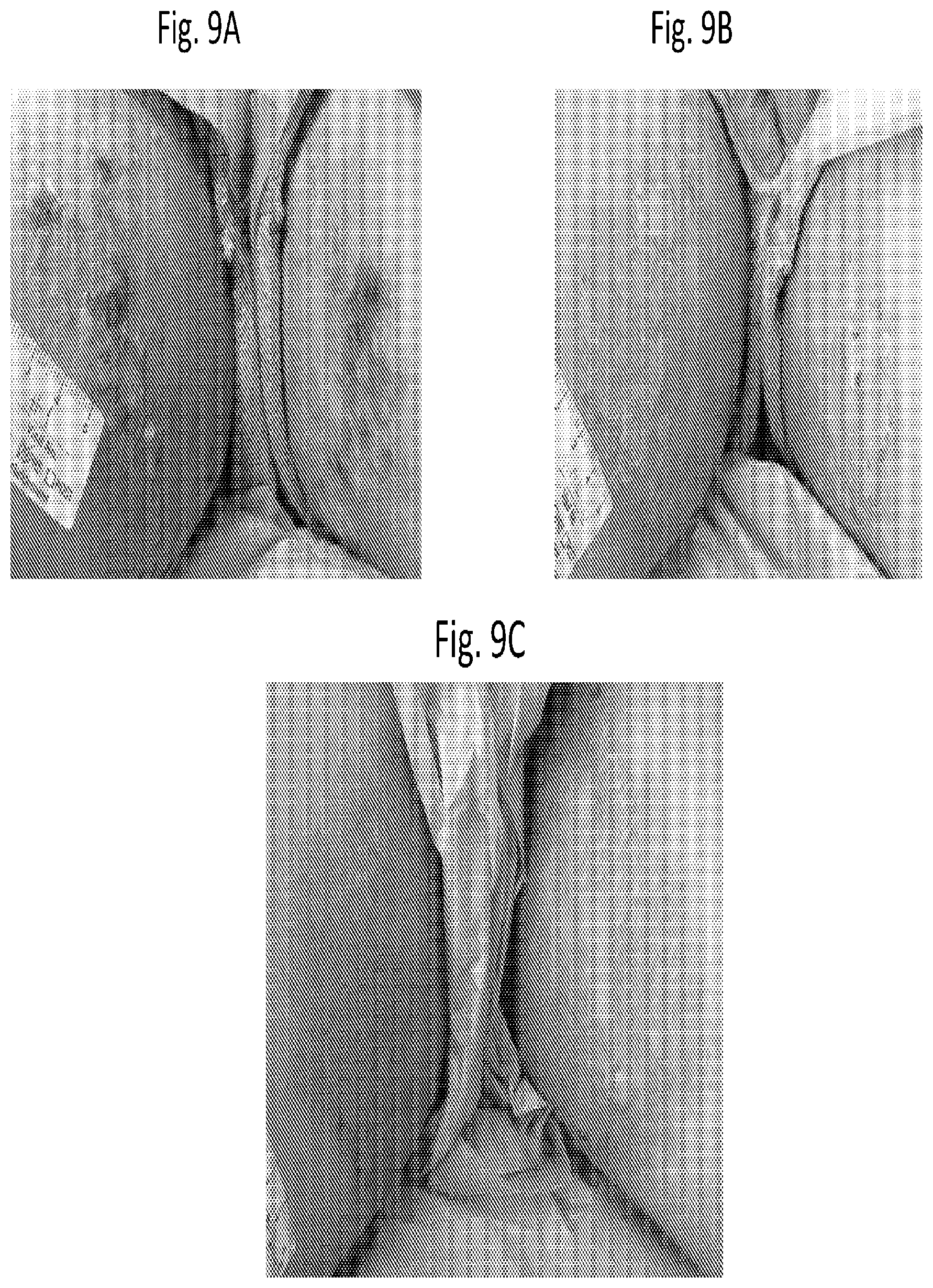 Patent US12616666 Figure 12 – Coenzyme Q10 formulations in the treatment and prevention of epidermolysis bullosa