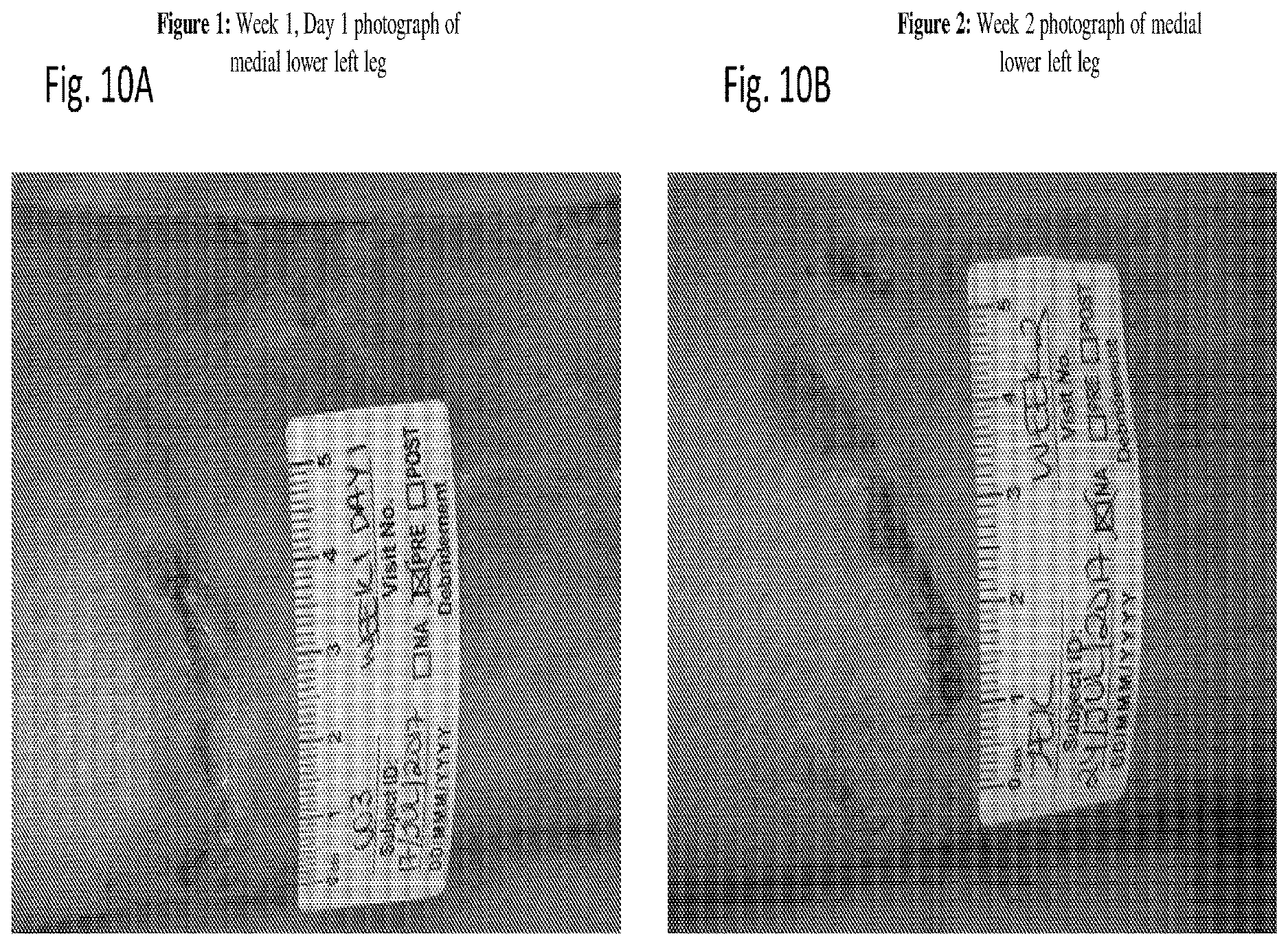 Patent US12616666 Figure 13 – Coenzyme Q10 formulations in the treatment and prevention of epidermolysis bullosa