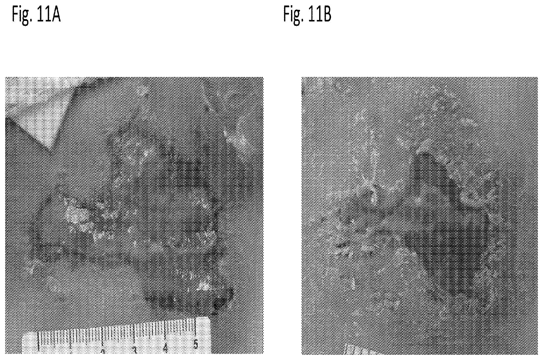 Patent US12616666 Figure 15 – Coenzyme Q10 formulations in the treatment and prevention of epidermolysis bullosa