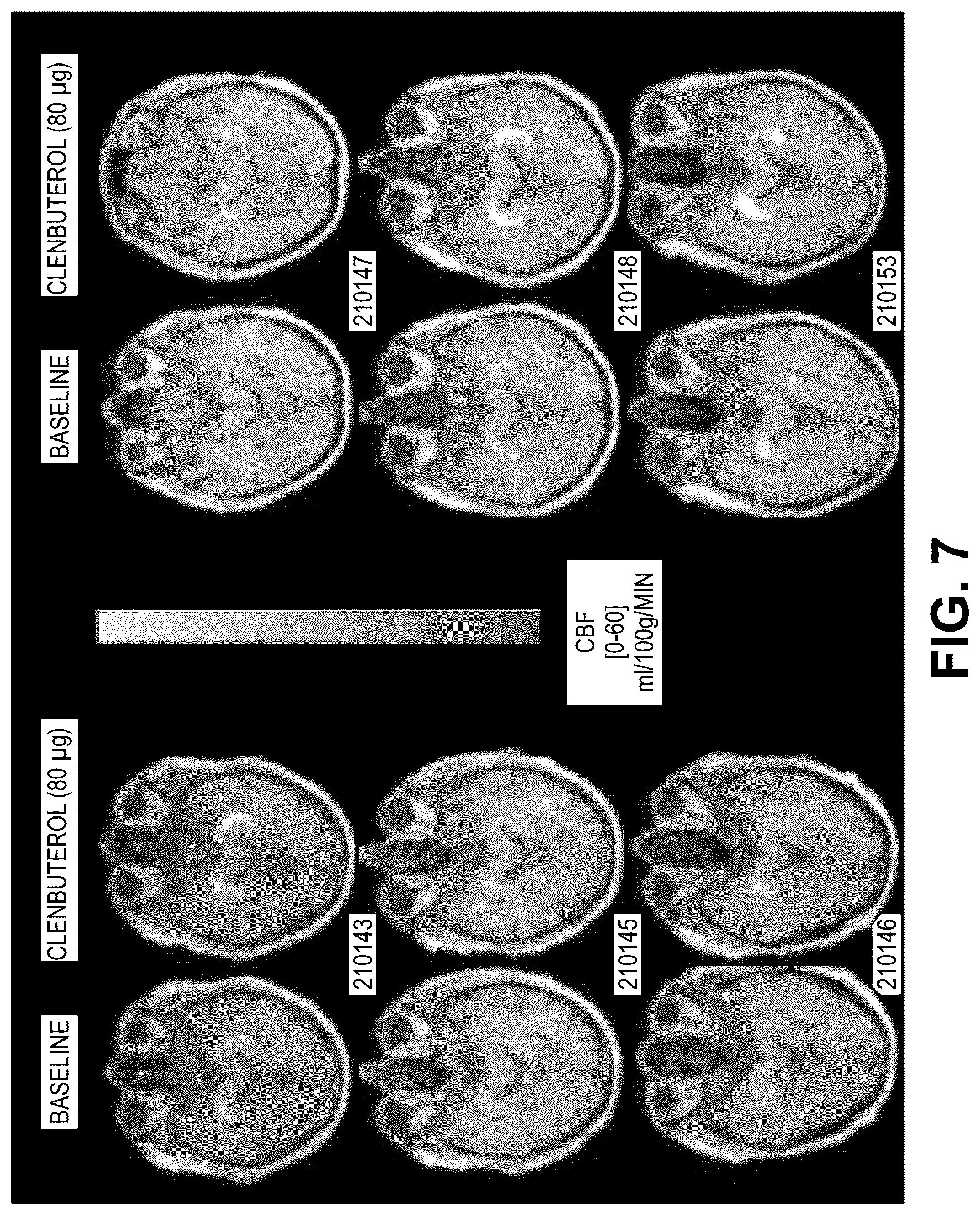 Patent US12616667 Figure 7 – Compositions and methods for improving neurological diseases and disorders