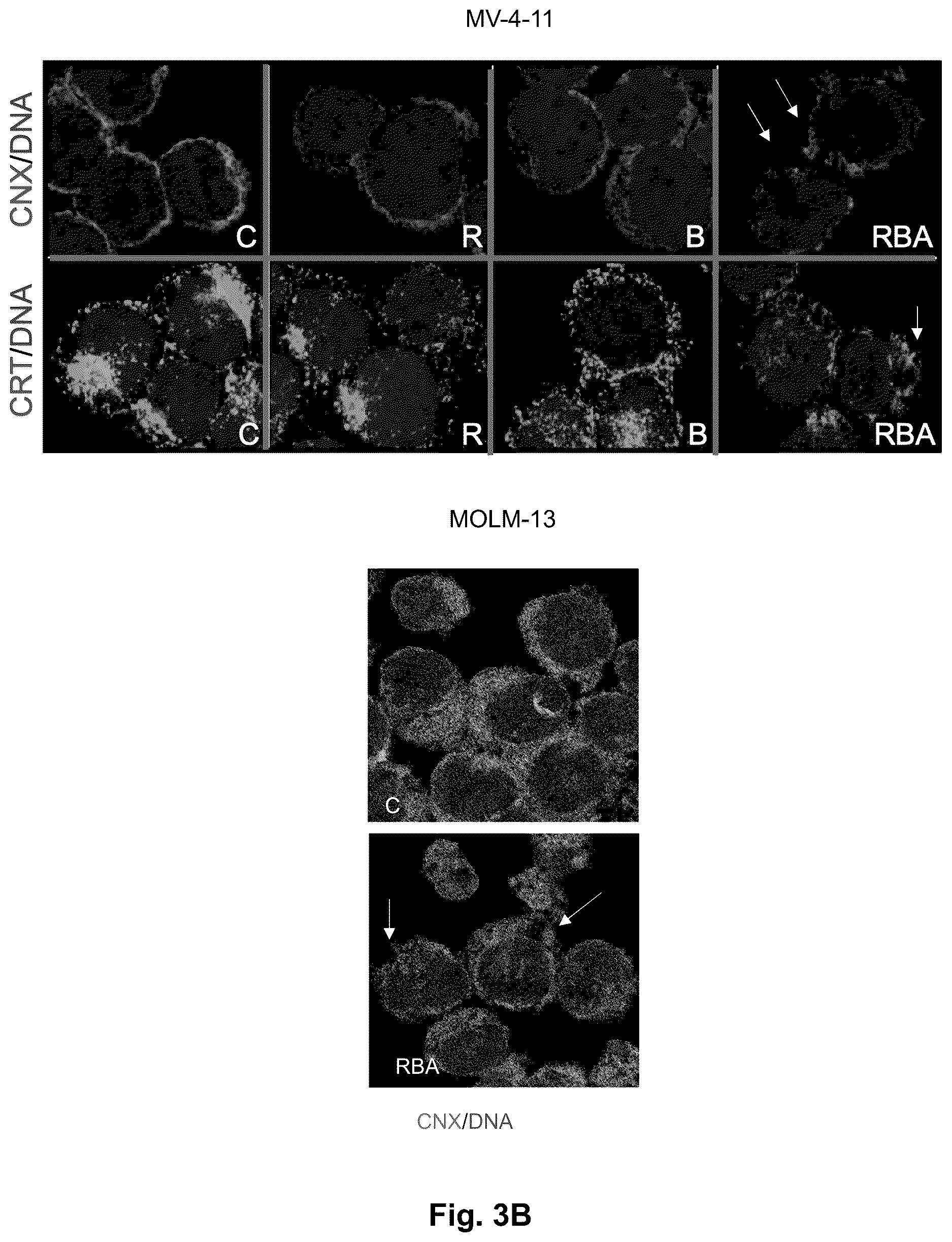 Patent US12616673 Figure 4 – Compounds for use in the treatment of leukemia