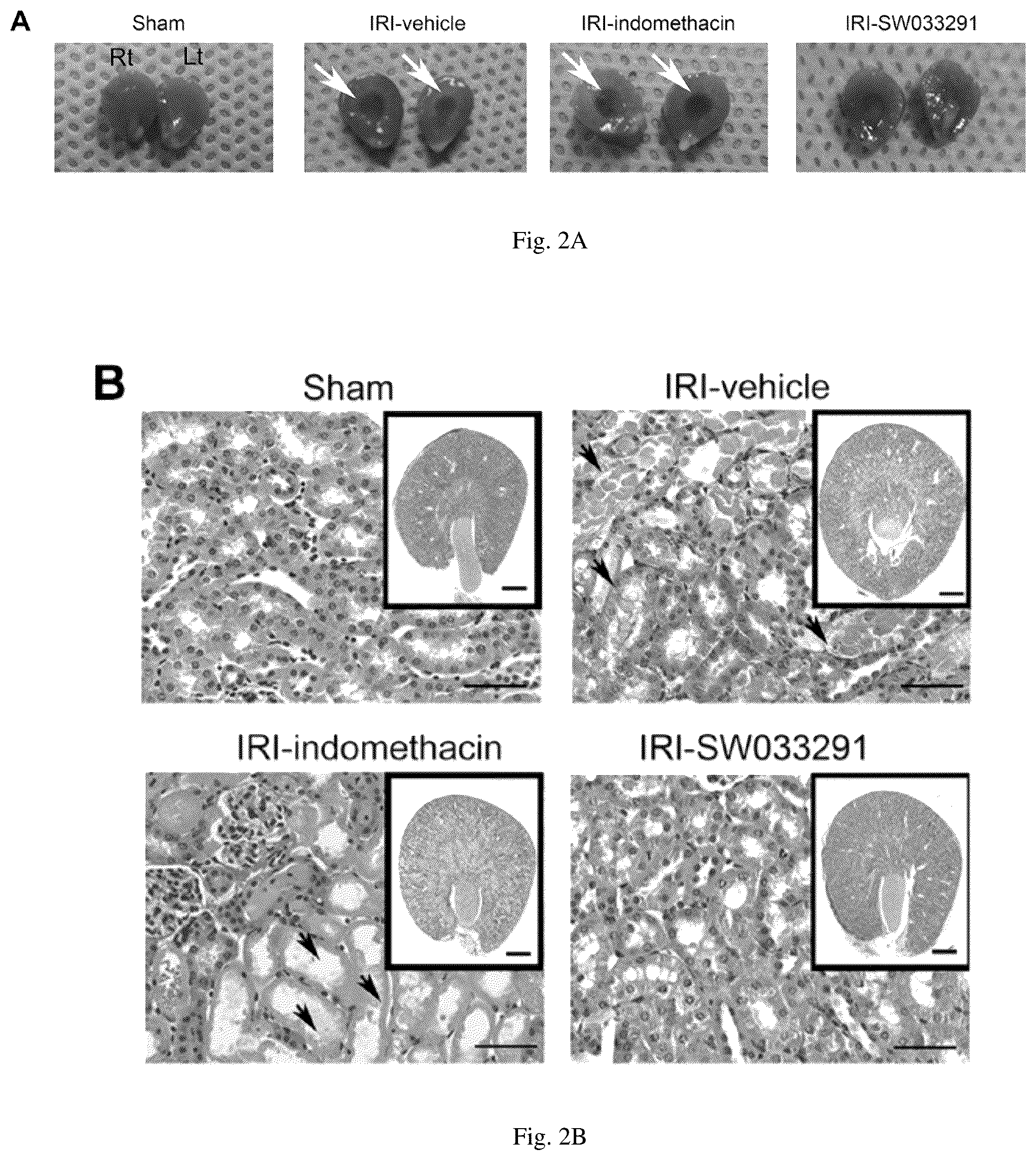 Patent US12616681 Figure 4 – Compositions and methods for treating renal injury