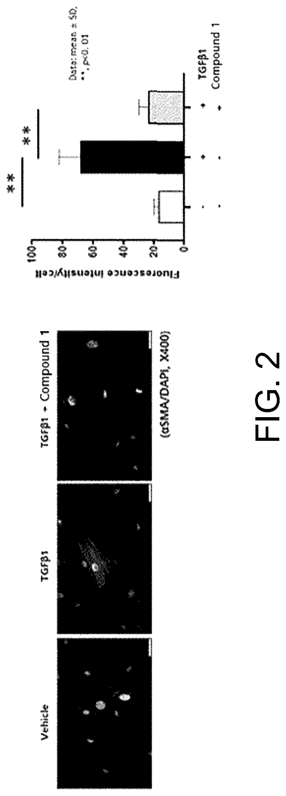Patent US12616684 Figure 2 – Pulmonary fibrosis medicine containing pyrazole derivative