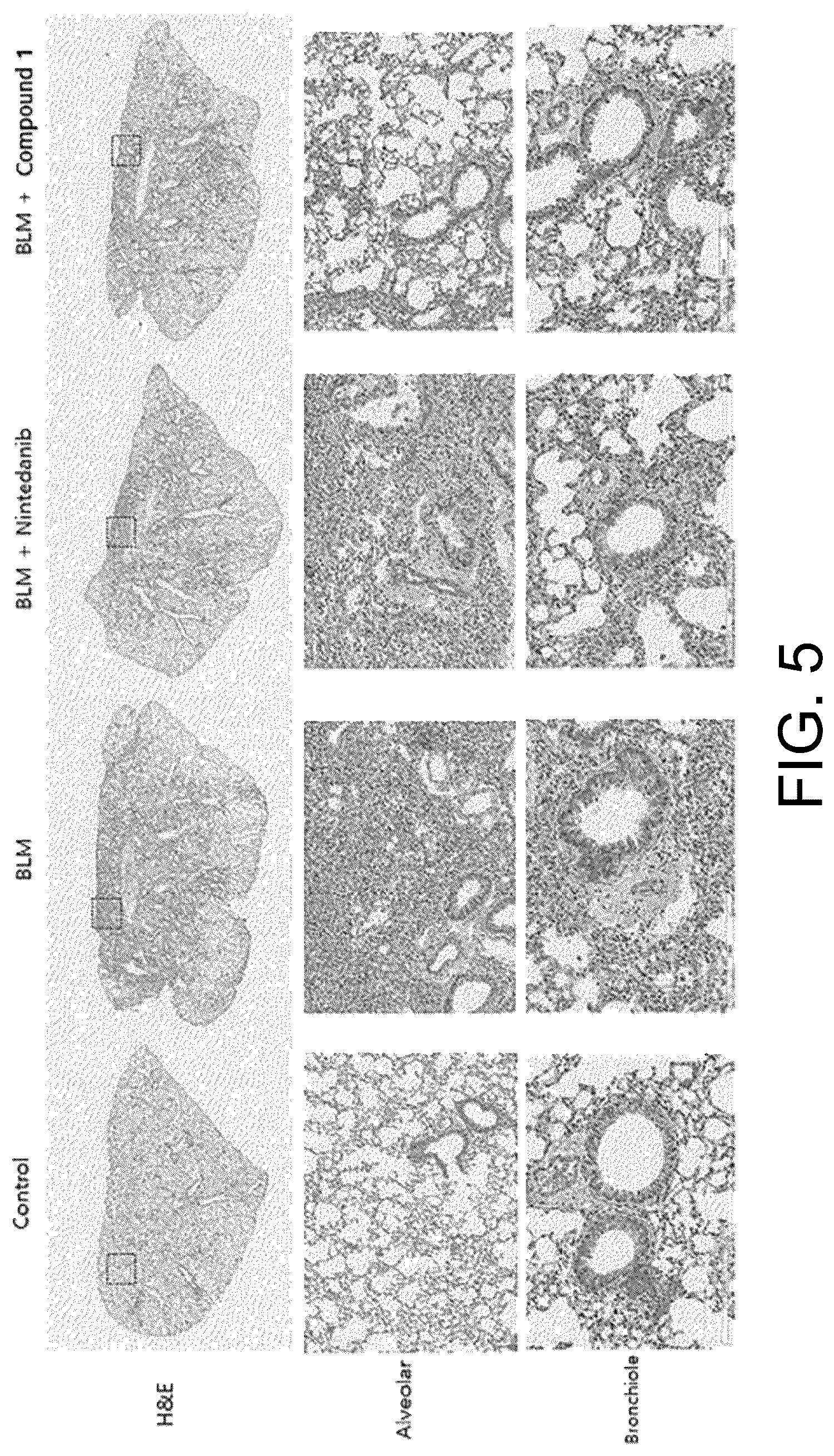 Patent US12616684 Figure 5 – Pulmonary fibrosis medicine containing pyrazole derivative