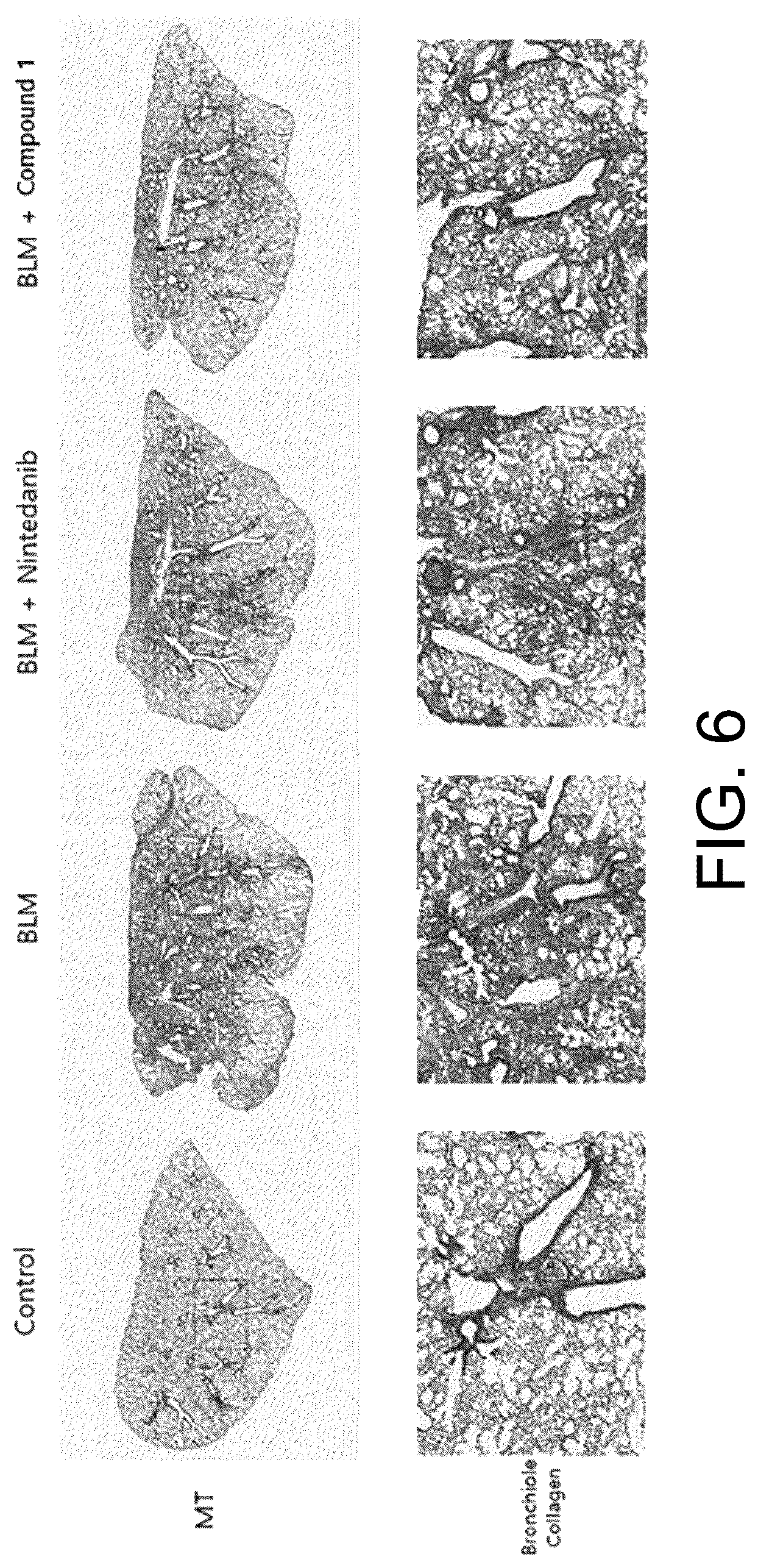 Patent US12616684 Figure 6 – Pulmonary fibrosis medicine containing pyrazole derivative