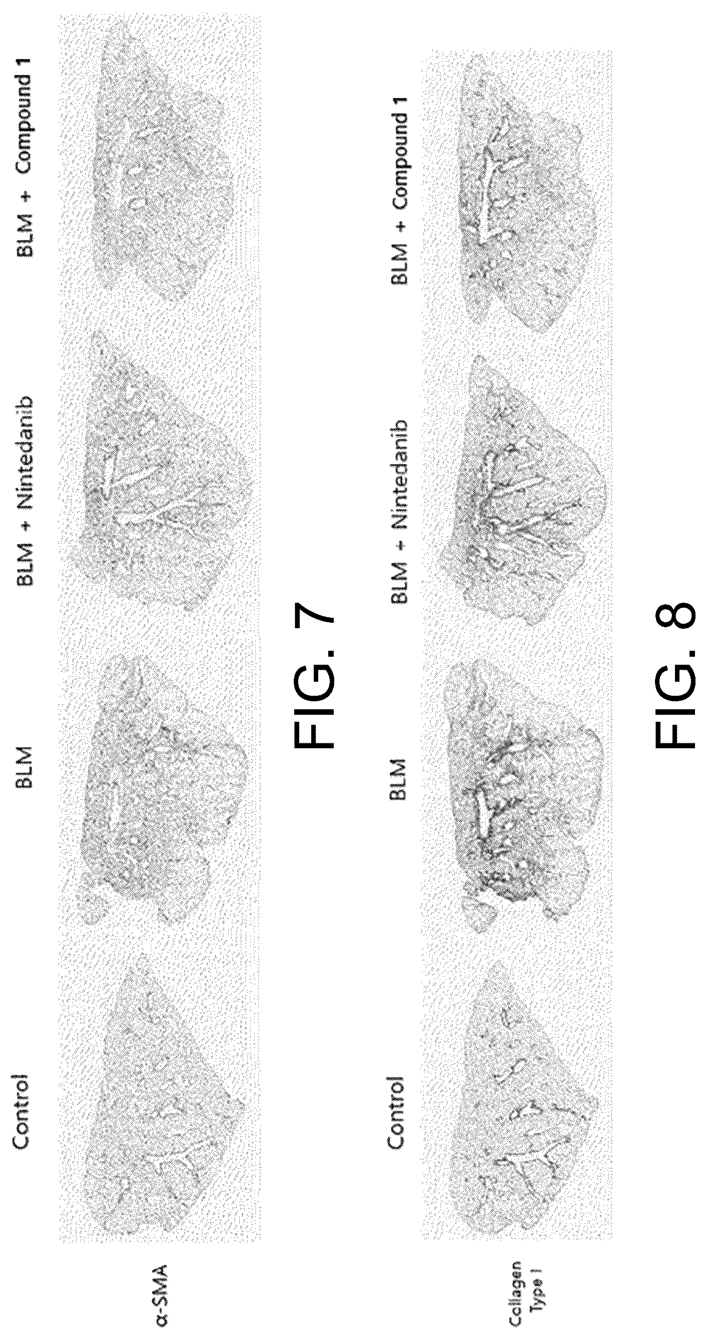 Patent US12616684 Figure 7 – Pulmonary fibrosis medicine containing pyrazole derivative